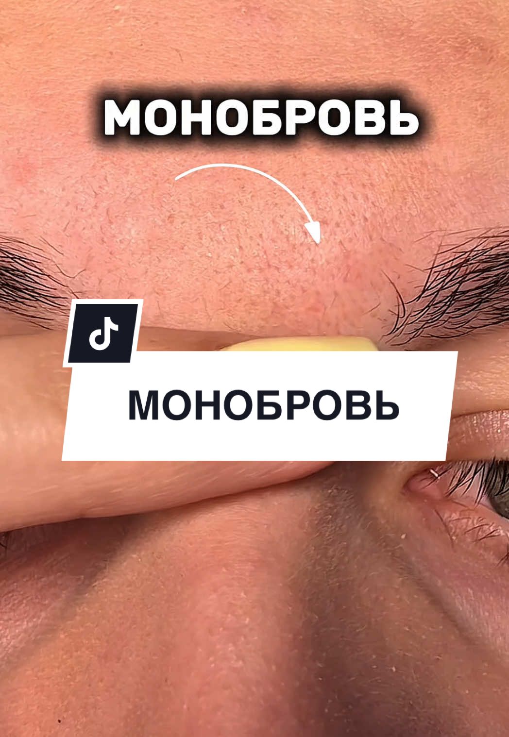 @Skin_wow