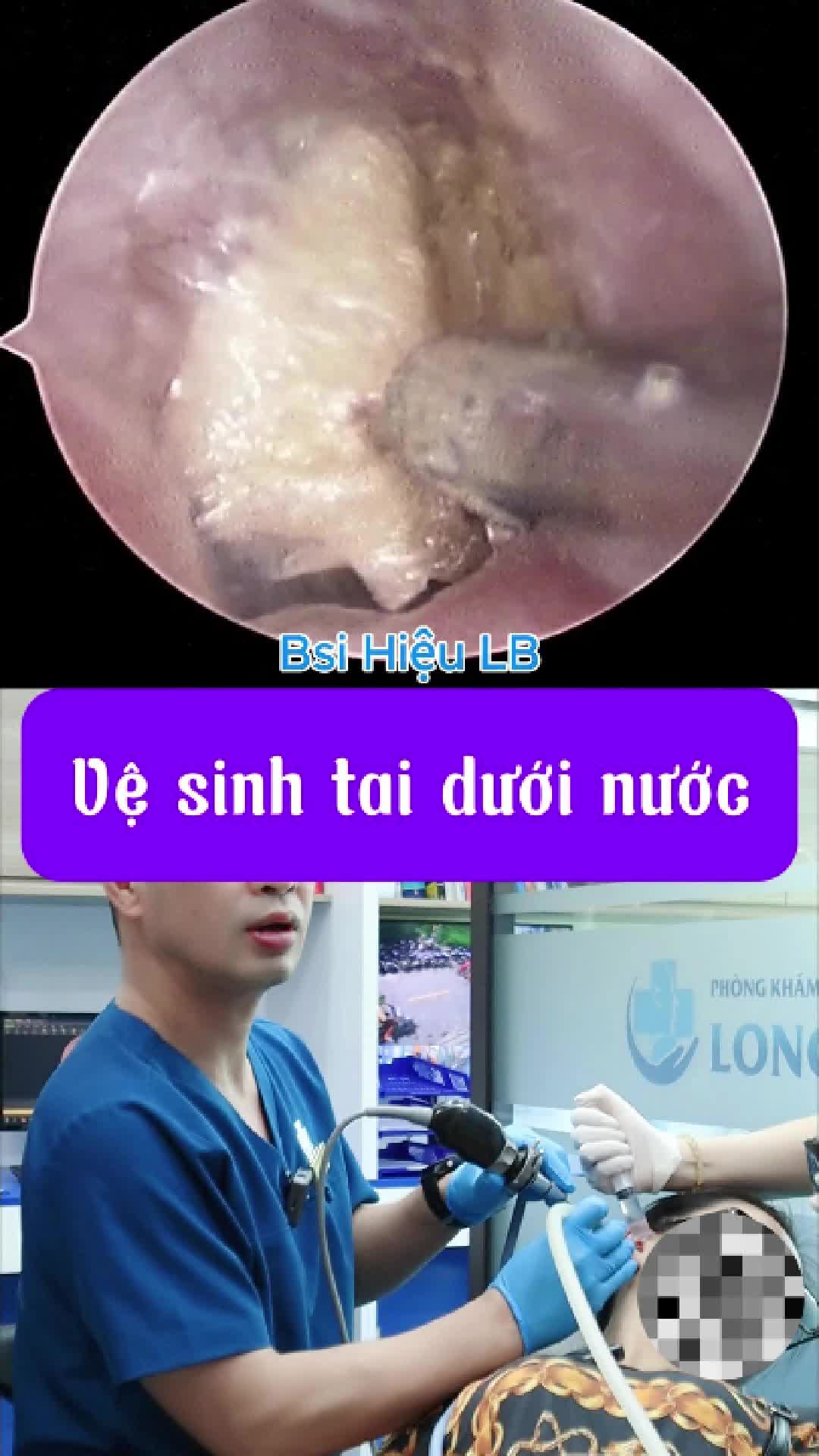 @Bs Hiệu Tai Mũi Họng Long Bi&ecirc;n