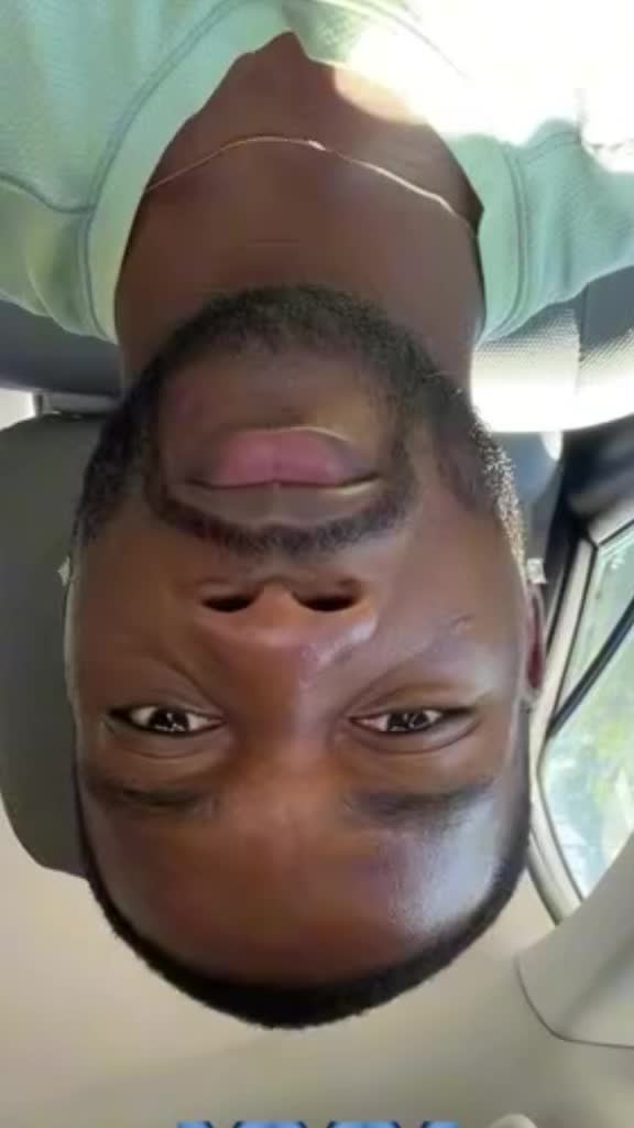 @osasioos.forehead