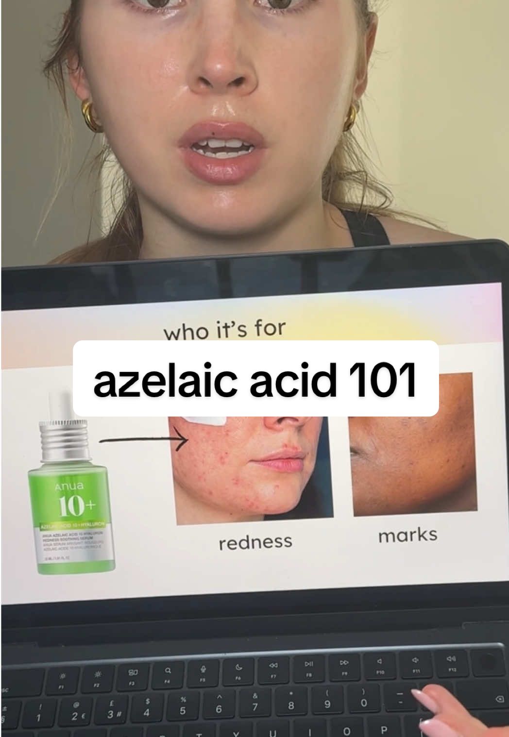 @Natalie O'Neill