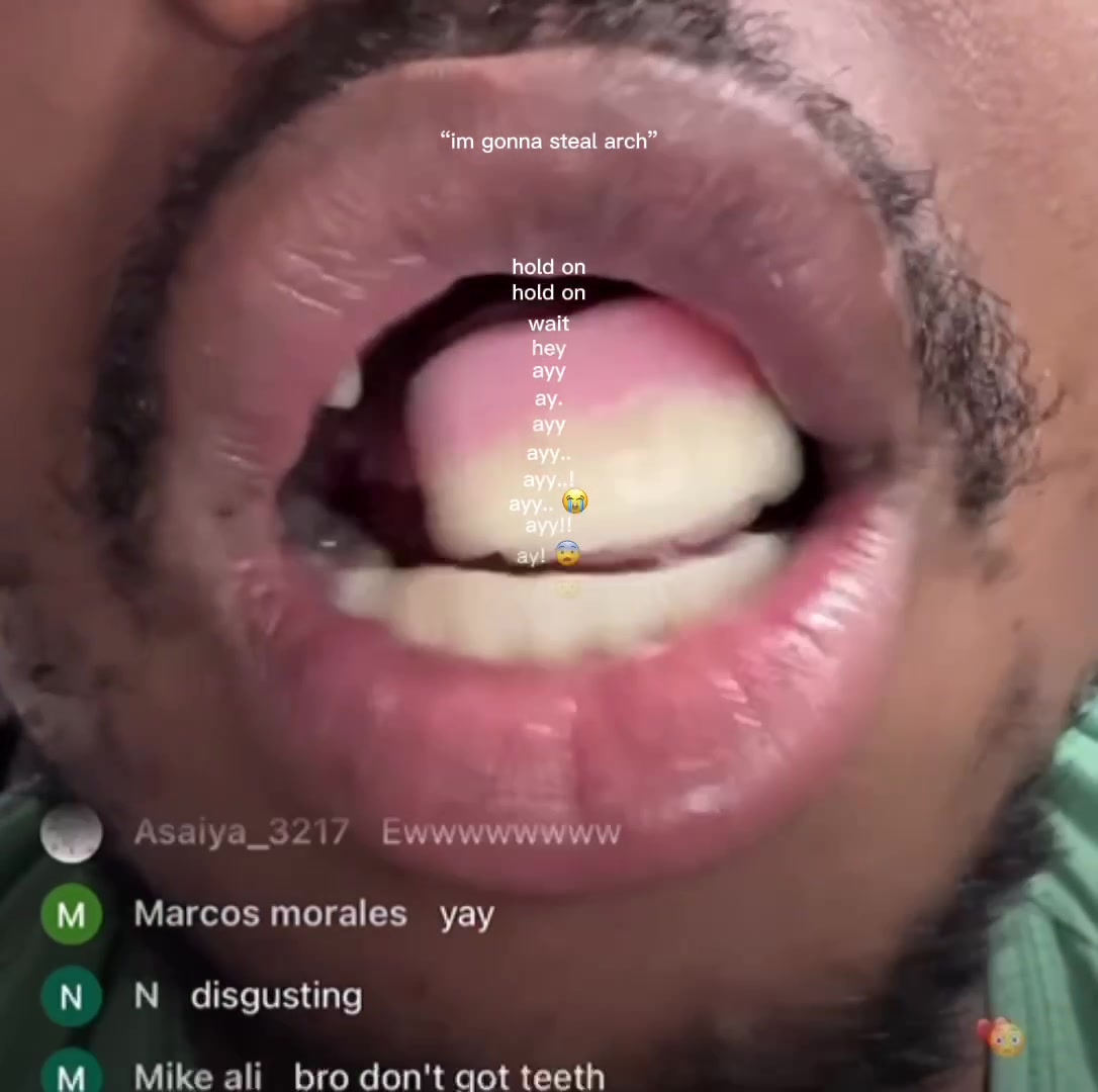 @Forestfangz