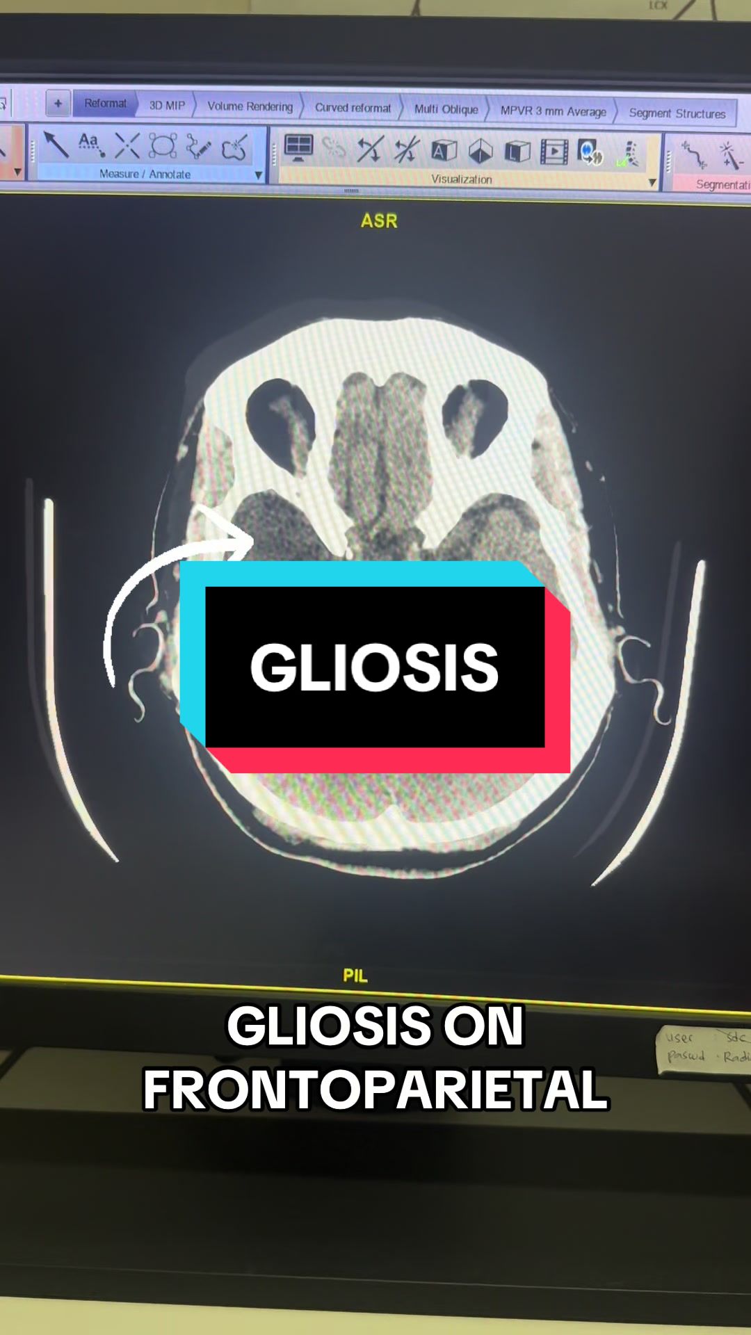 @Sobat Radiology