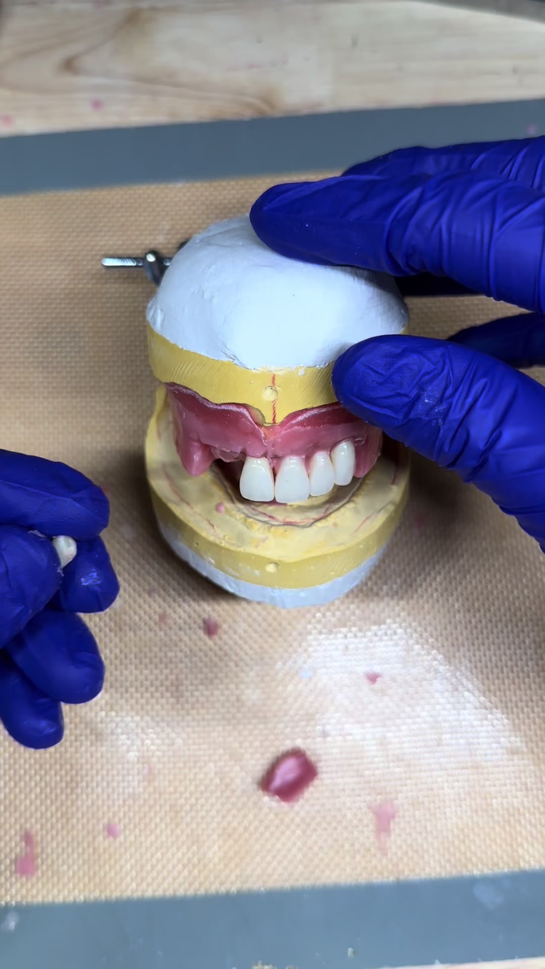 @Dental tech 🦷