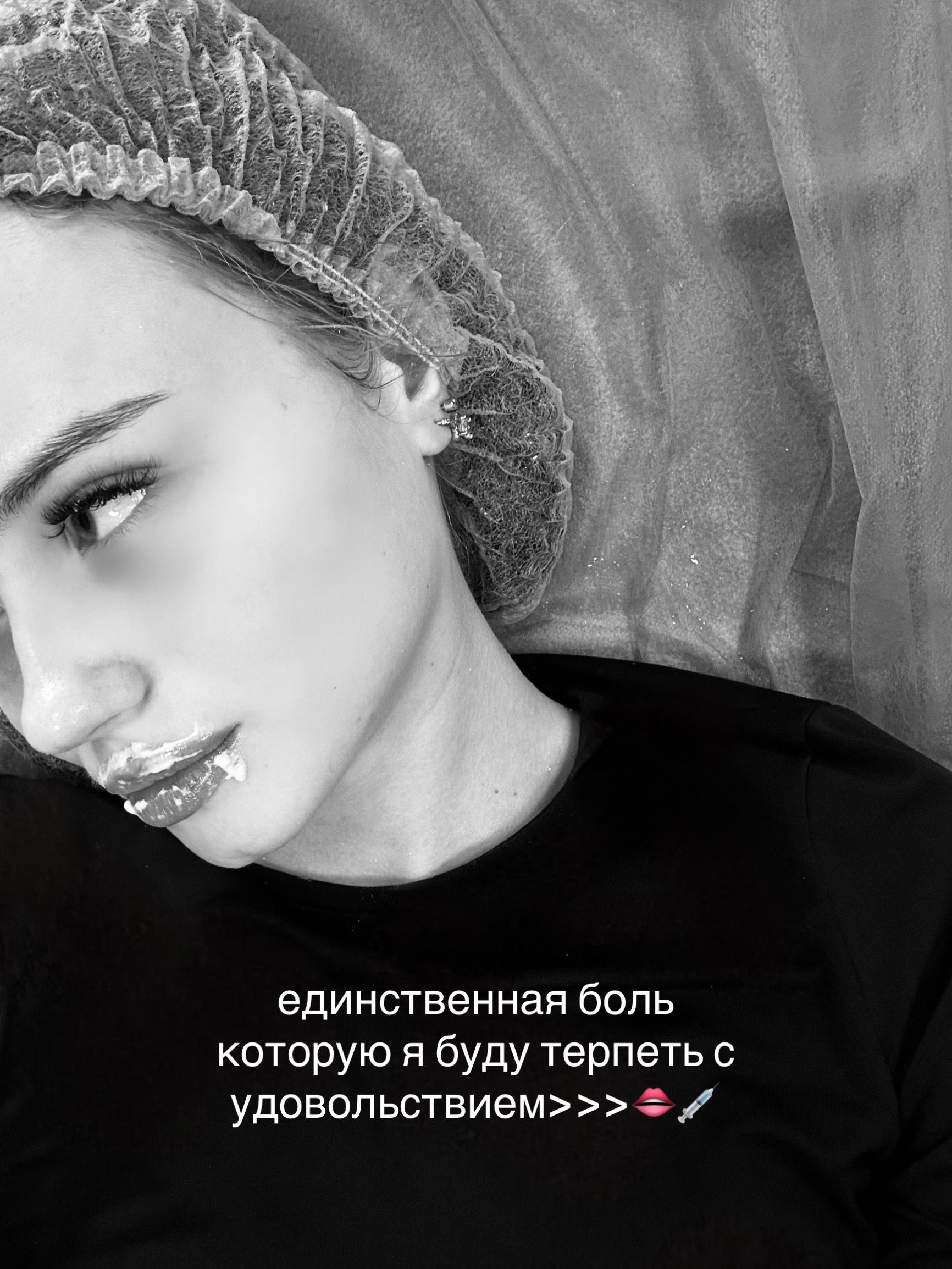 @миэлла
