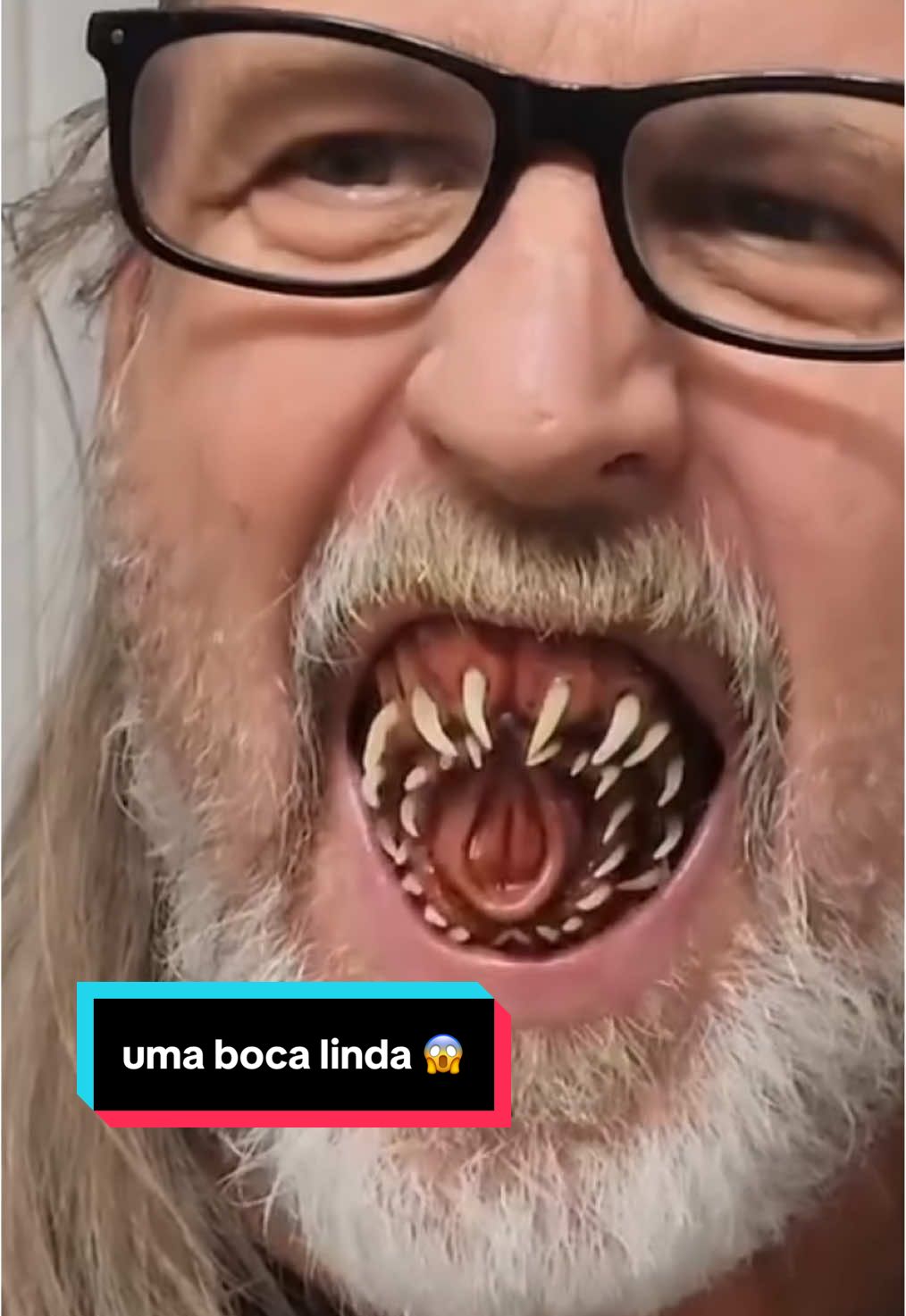 @Yago Stephano