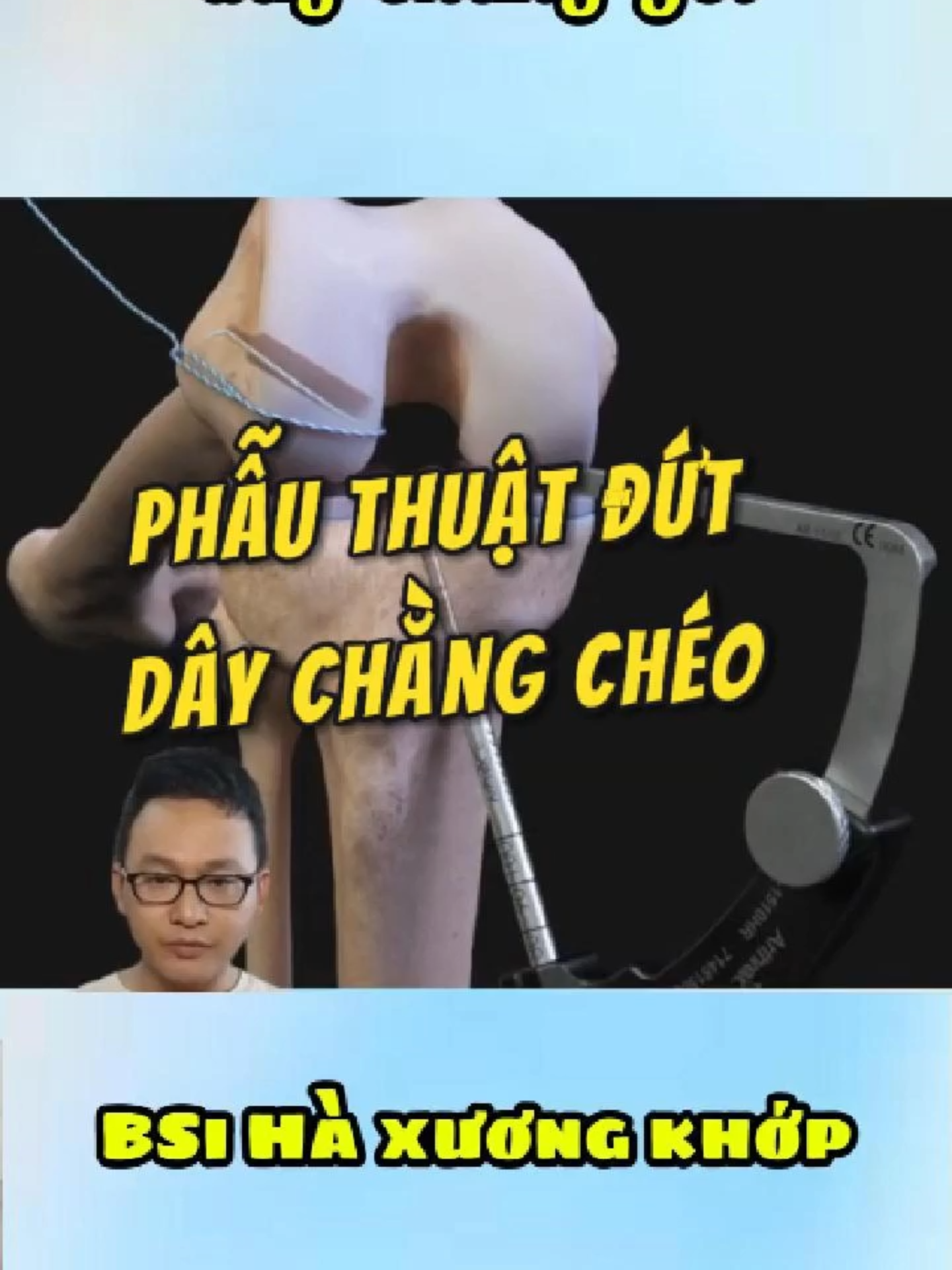 @Chuy&ecirc;n gia xương khớp