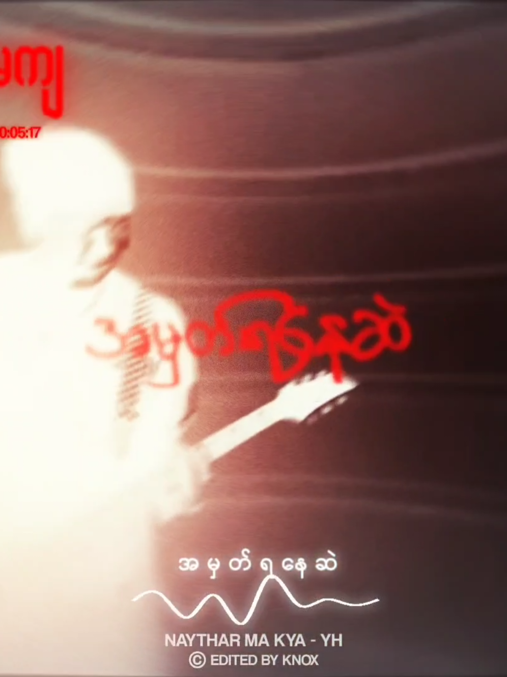 @𝐊𝐧𝐨𝐱&bull;[ᴍᴜsɪᴄ]★ ᪲᪲