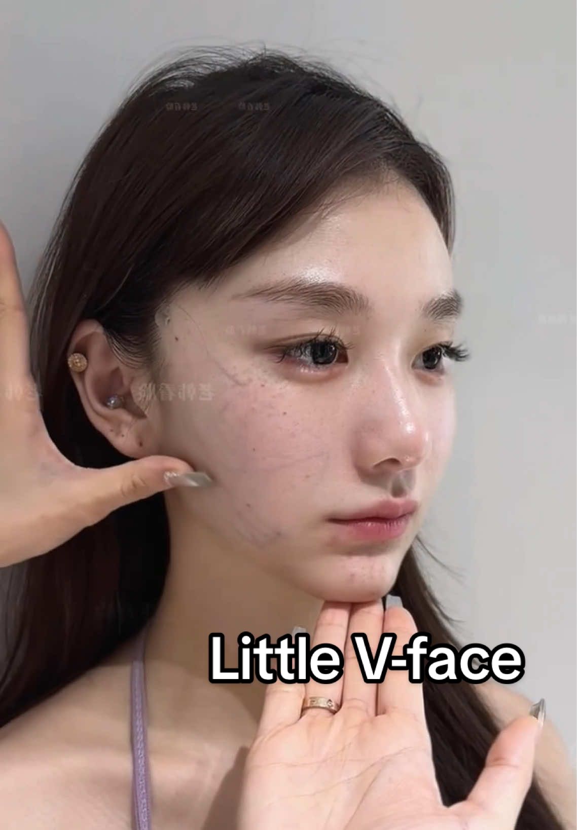 @Aesthetic Consultant QL
