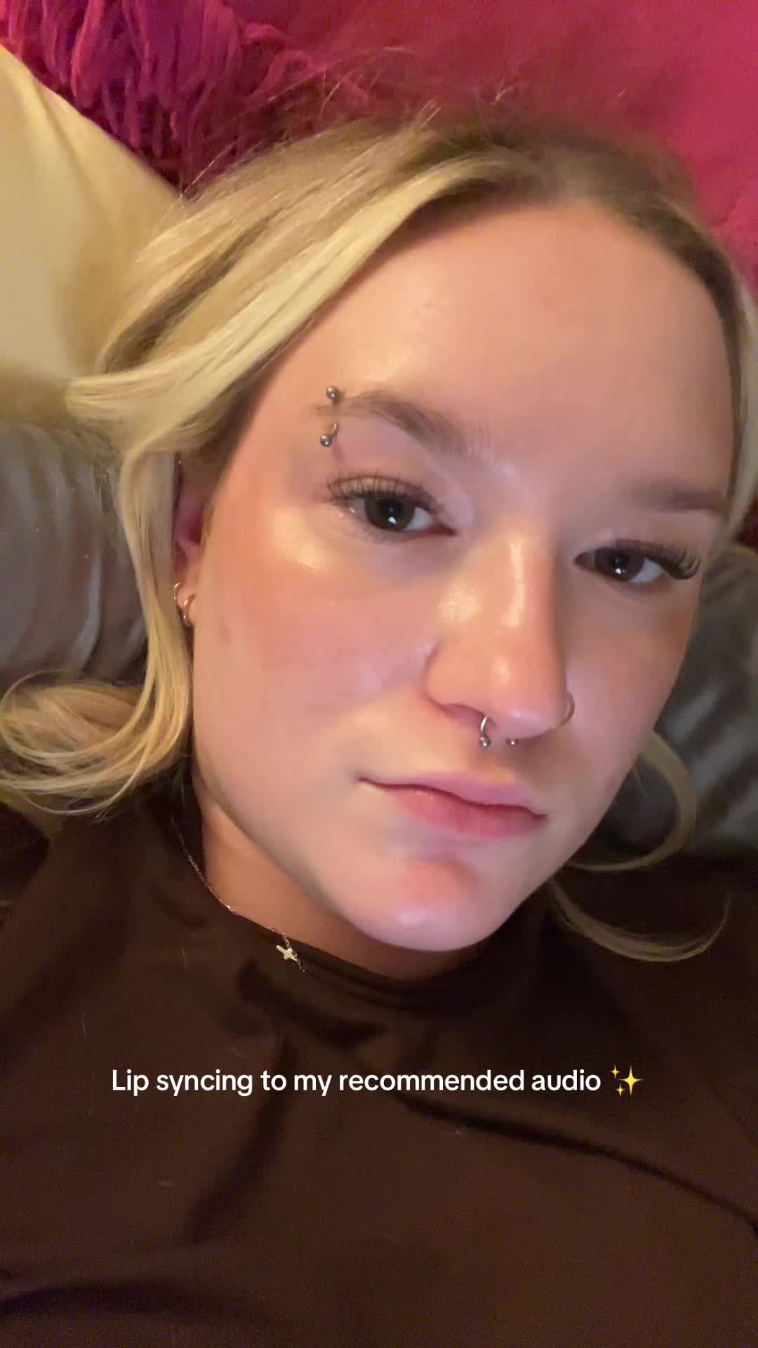@Bay | Acne Baddie ✨