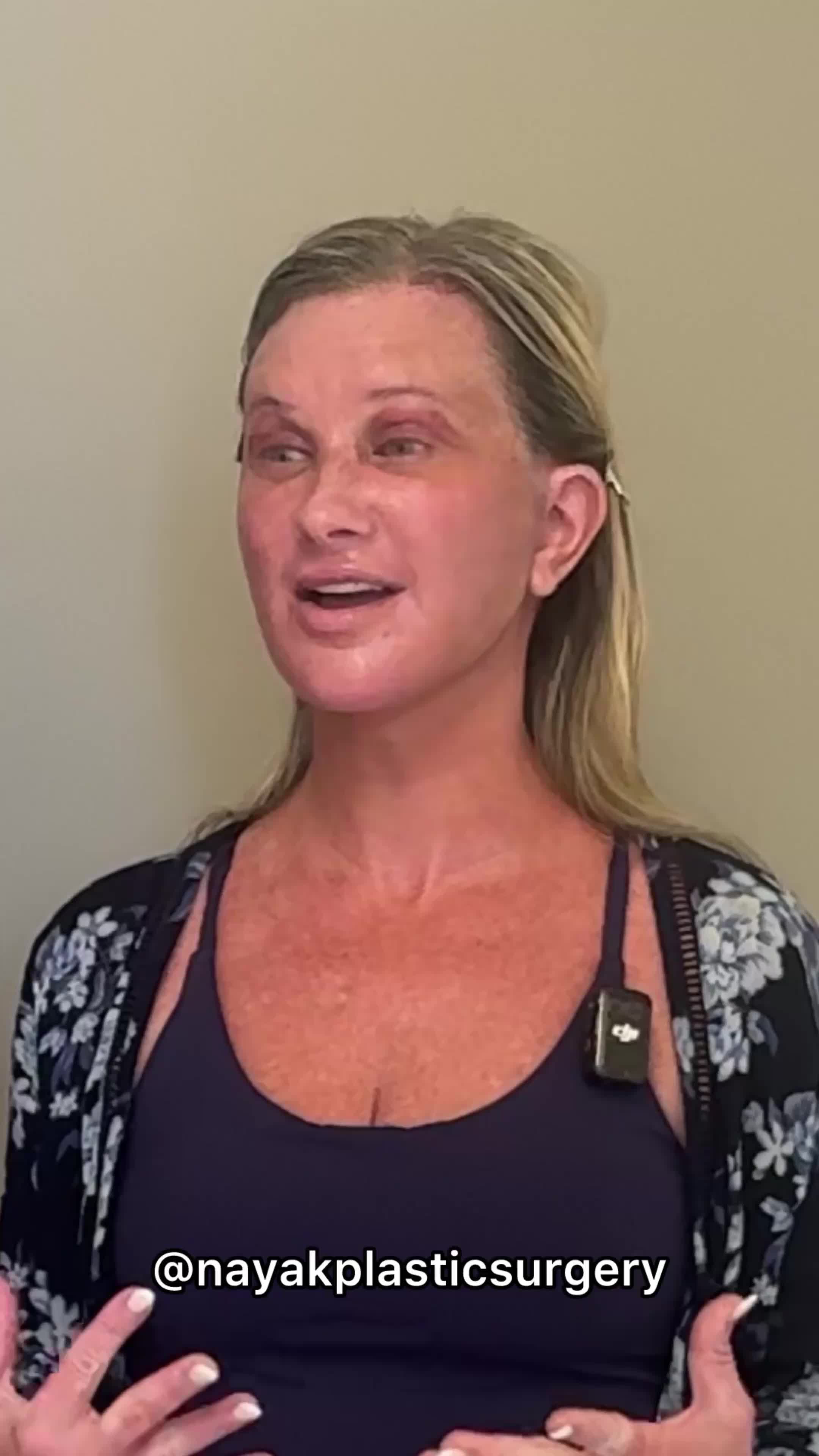 @NayakPlasticSurgery