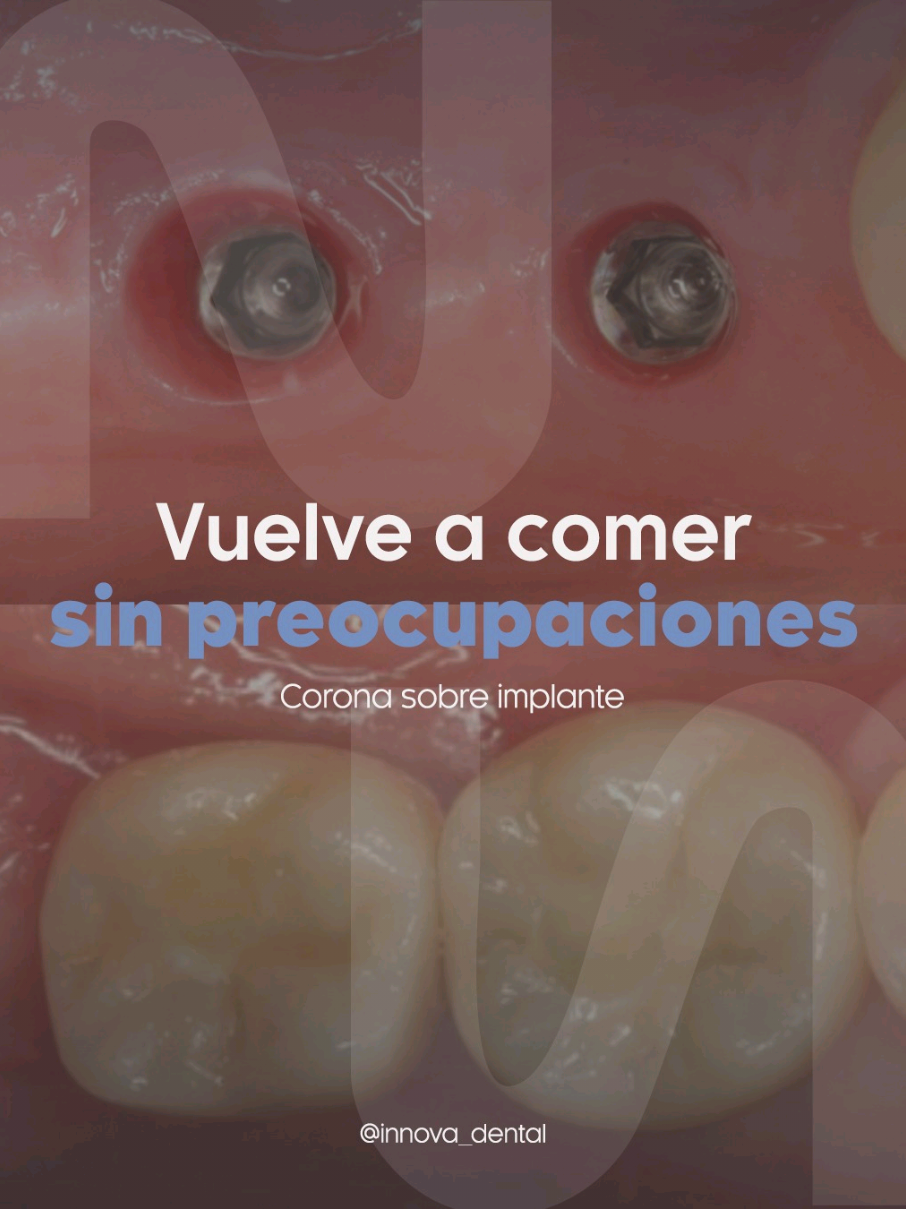 @Innova Dental Managua 🇳🇮