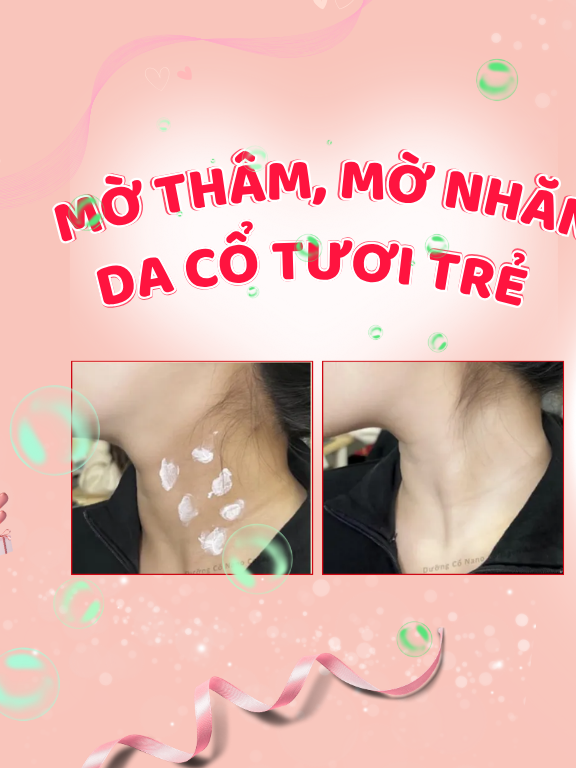 @Abera Miền Trung
