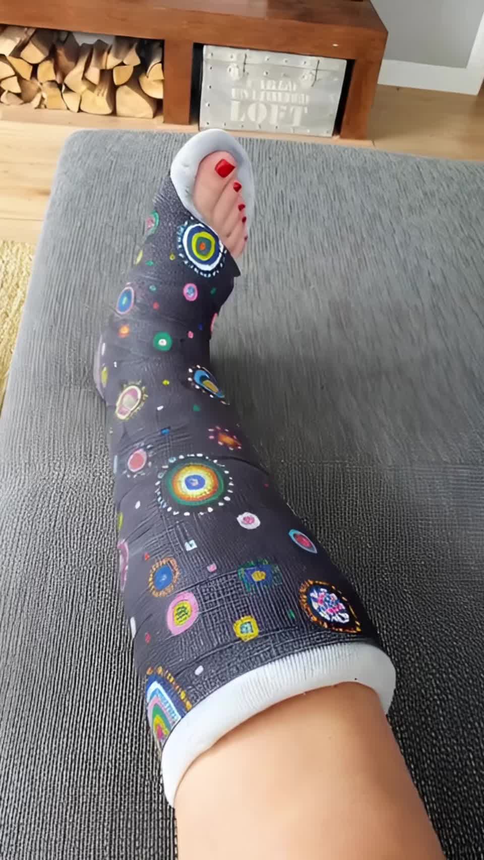 @Gips Fetish