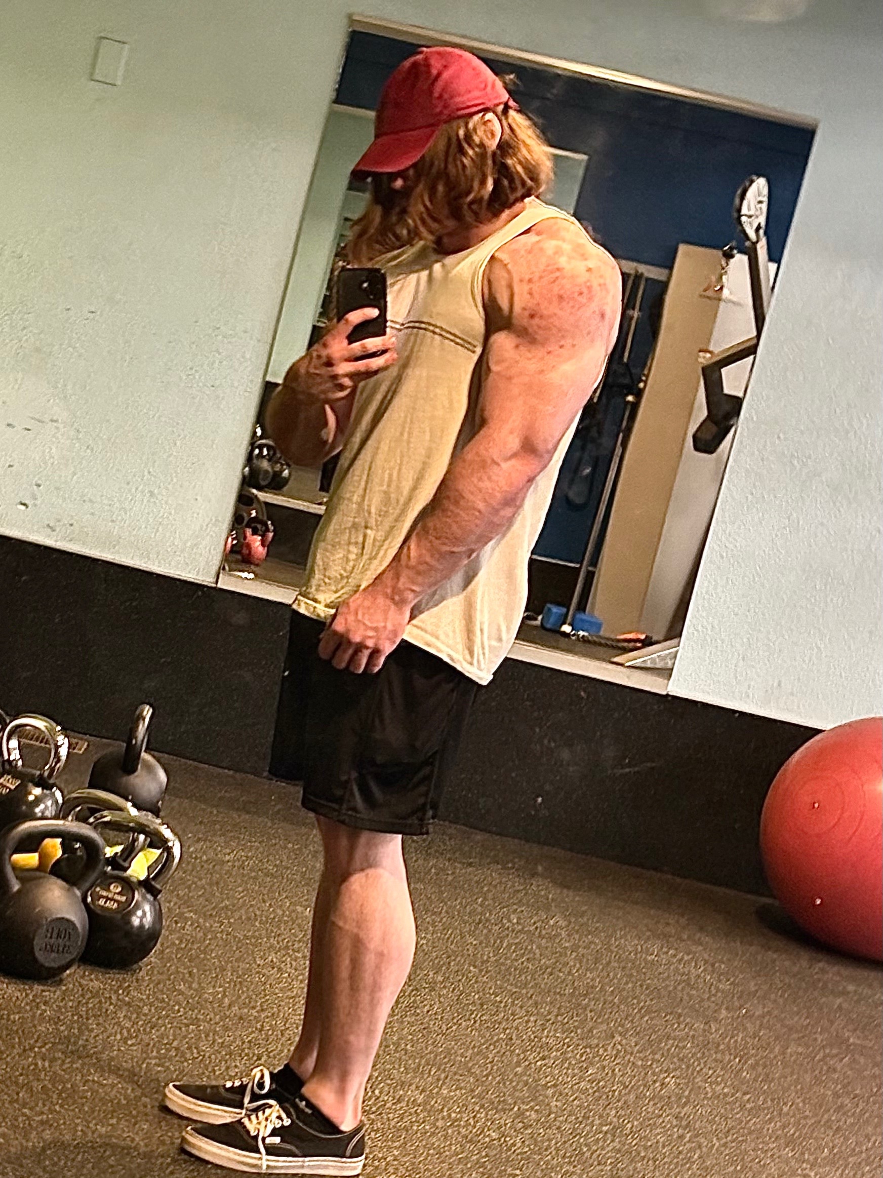 @LucasFit