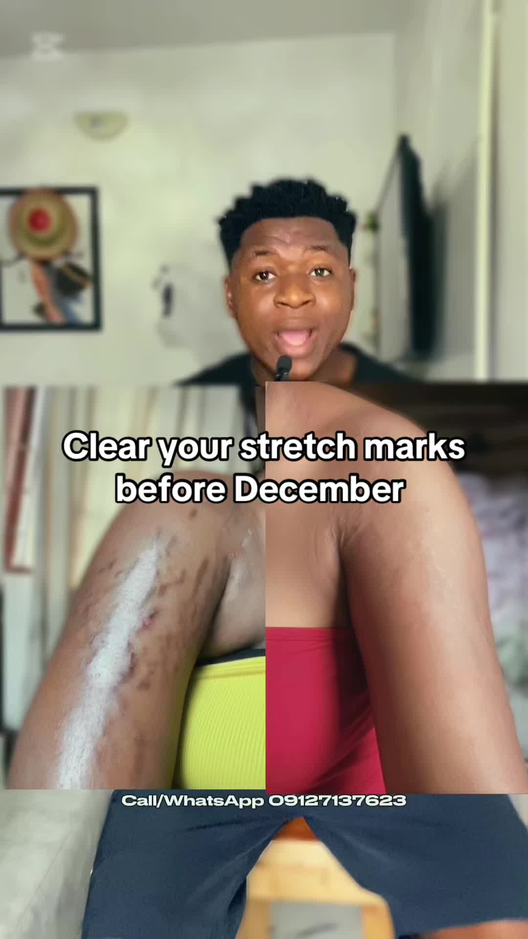 @Radiant skin