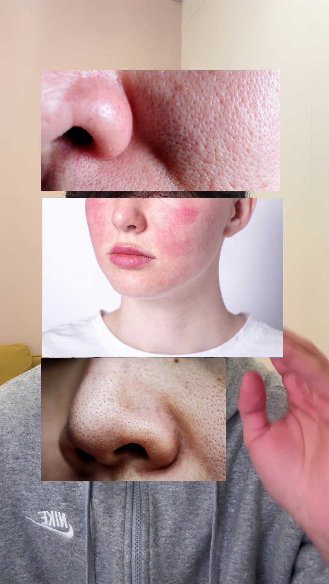 @Skincare tips 😇!!!