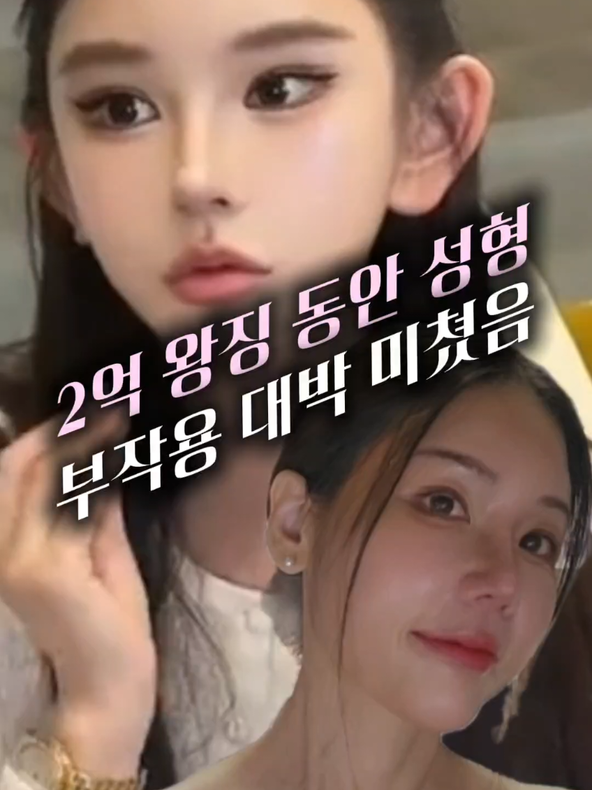 @지나스 GINAS