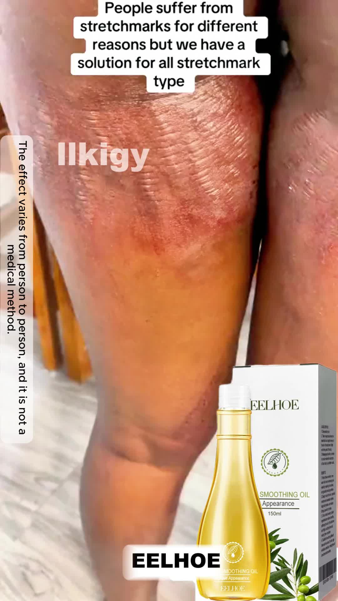 @llkigy
