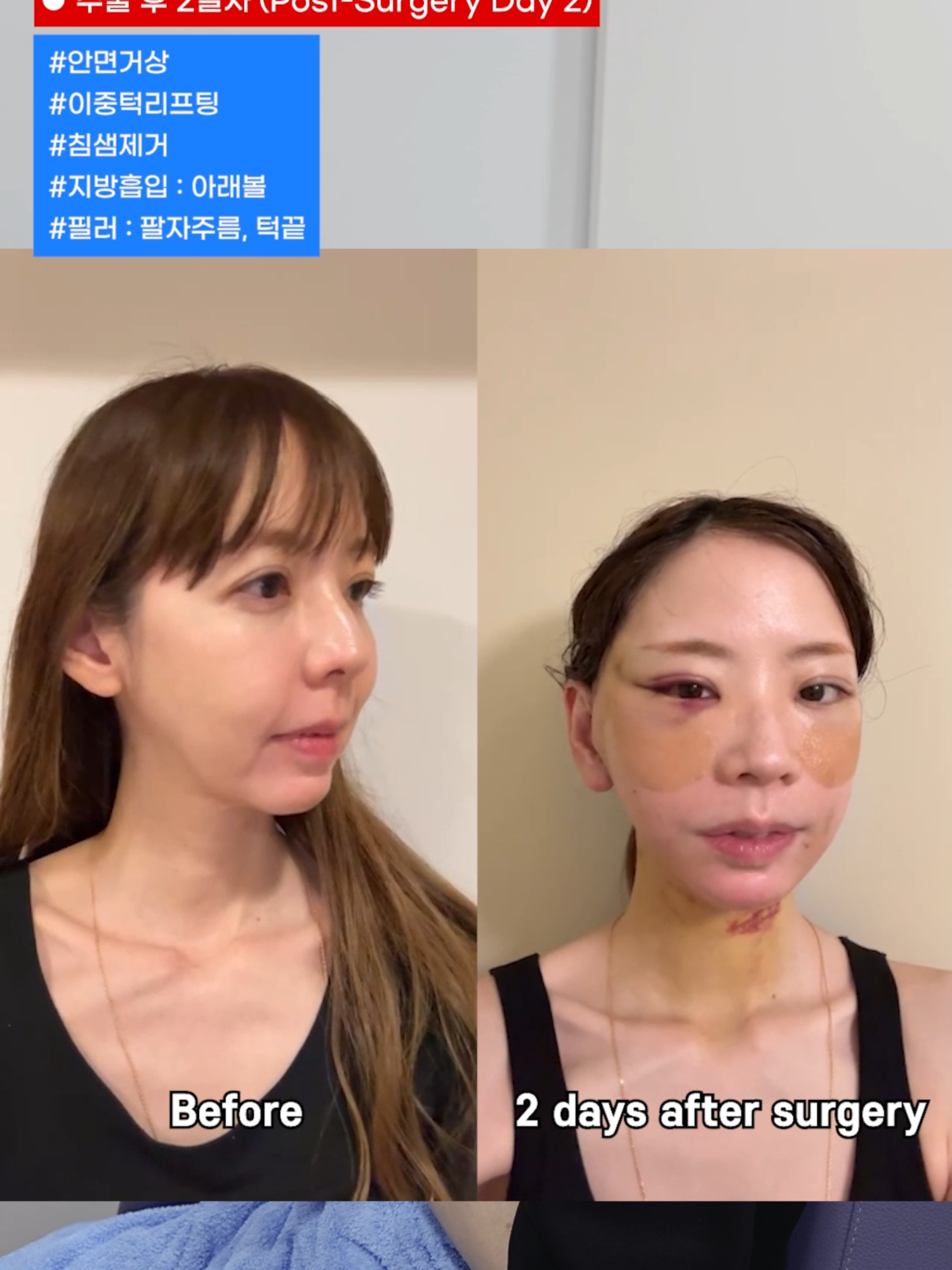 @다시피움성형외과 DASIPIUM タシピウム