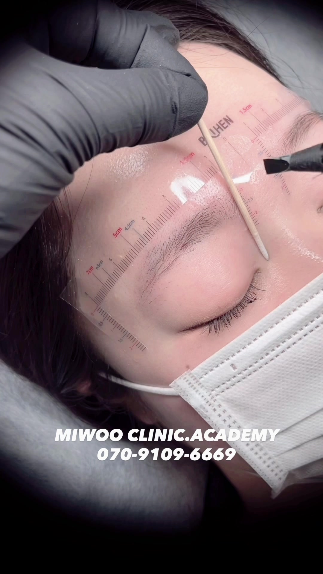 @MIWOO_CLINIC 大阪院
