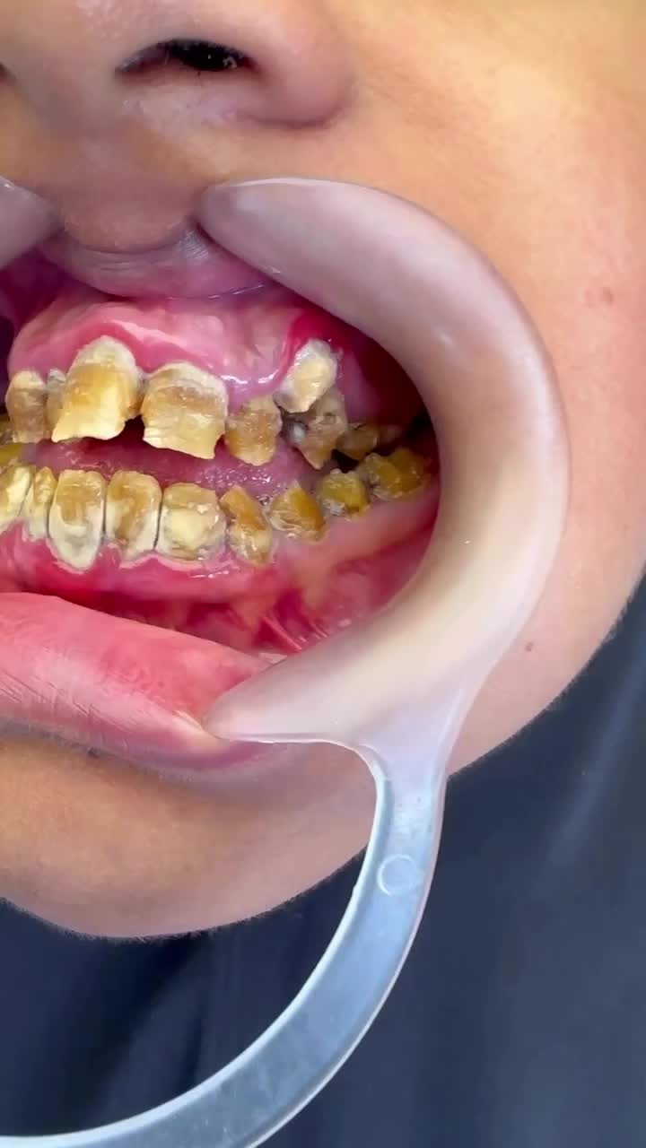 @DellDentalOfficial