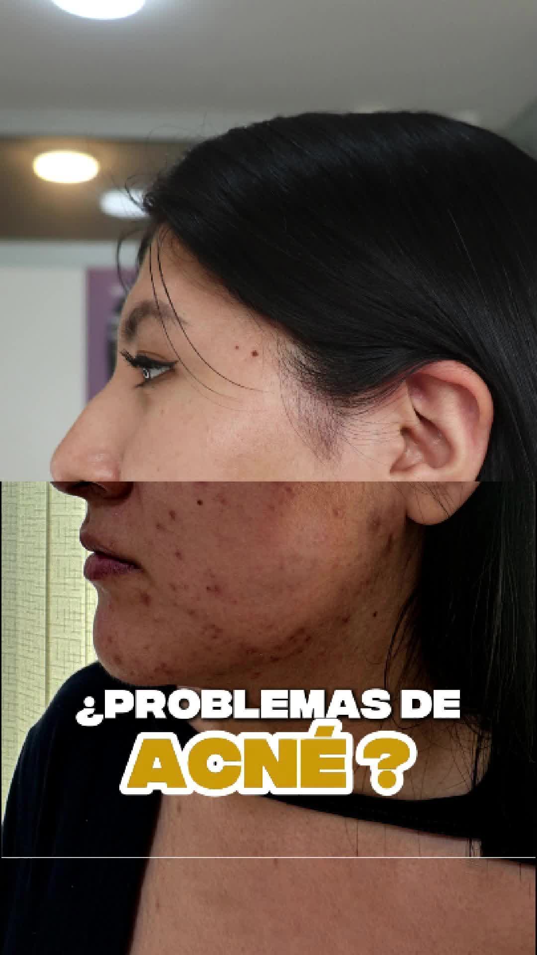 @RebellSpa