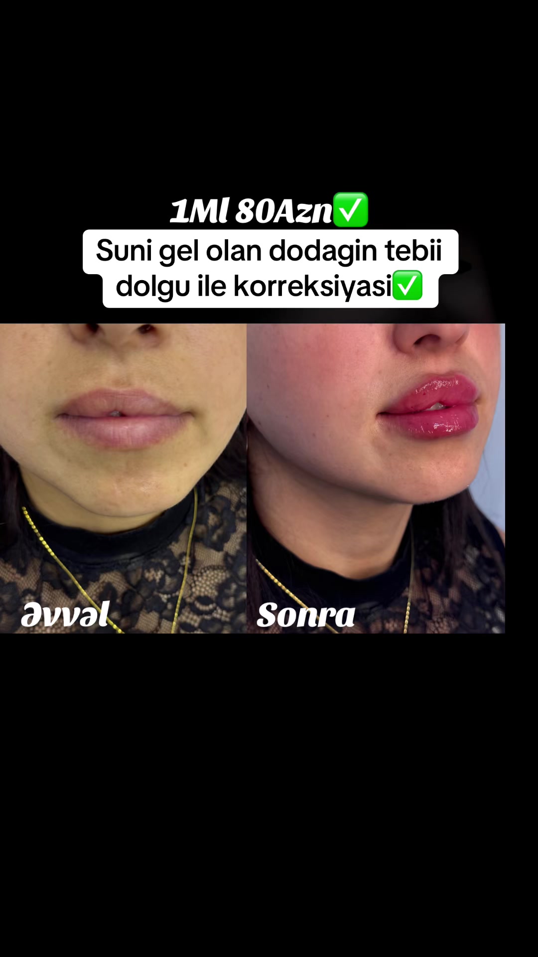 @Kosmetoloq_G&uuml;l&uuml;_Rajab