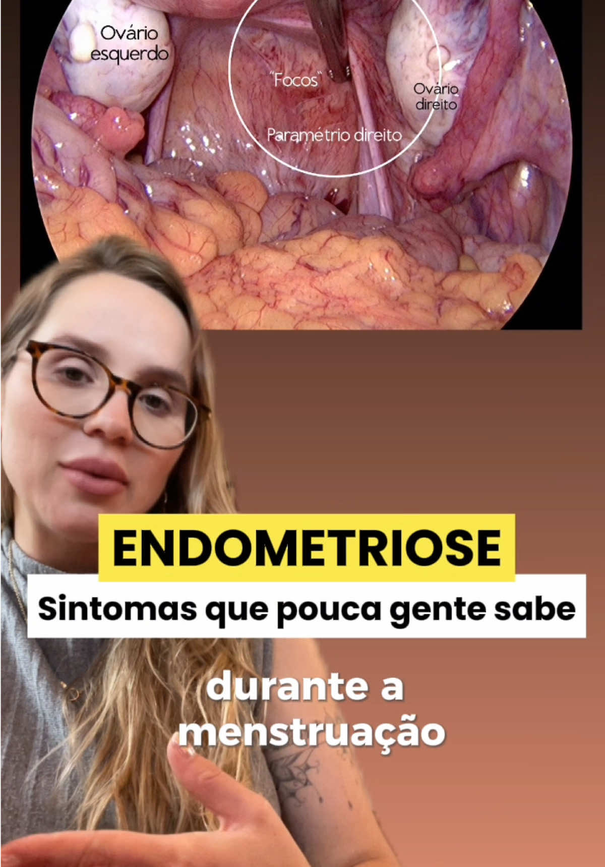 @Drabrunascalco