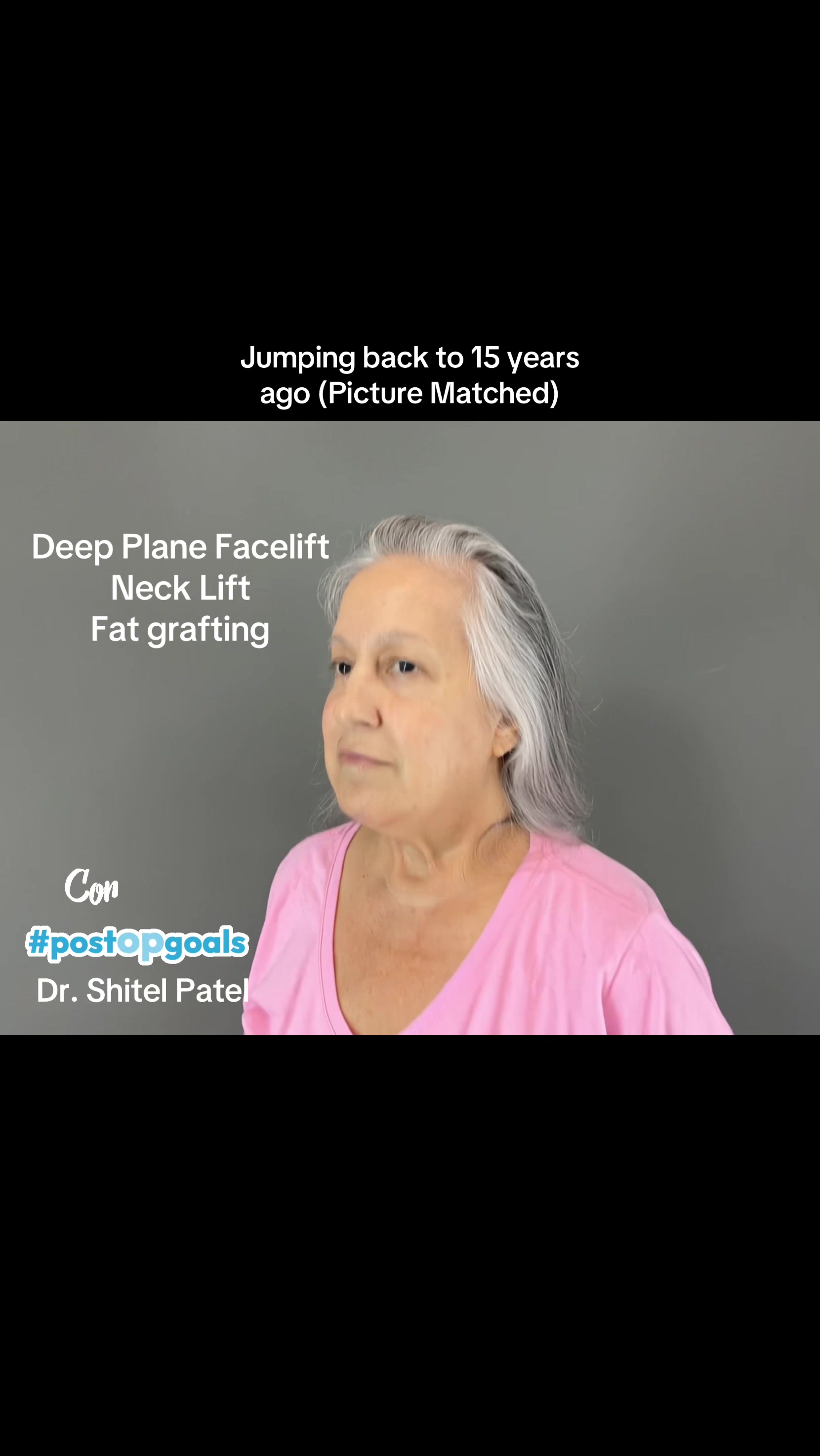 @Lift Plastic Surgery