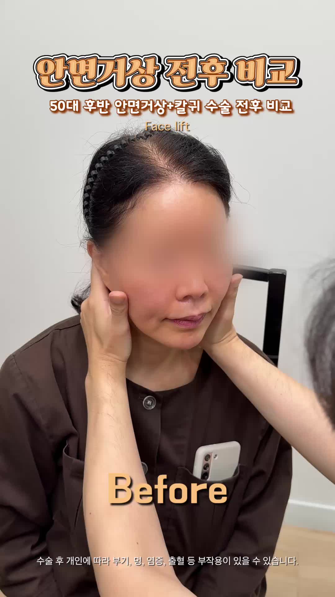 @리프성형외과