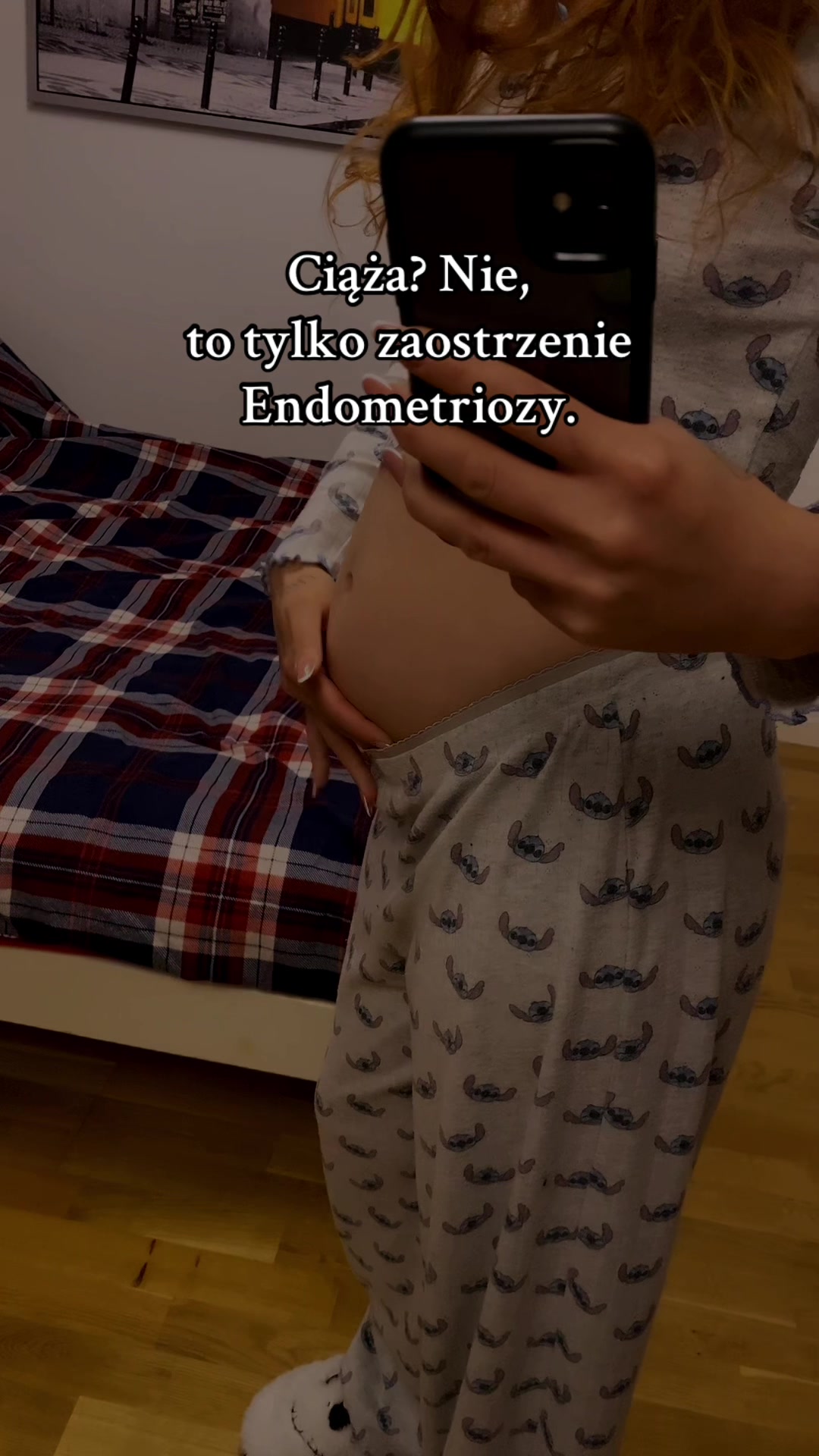 @EndoMona🎗️