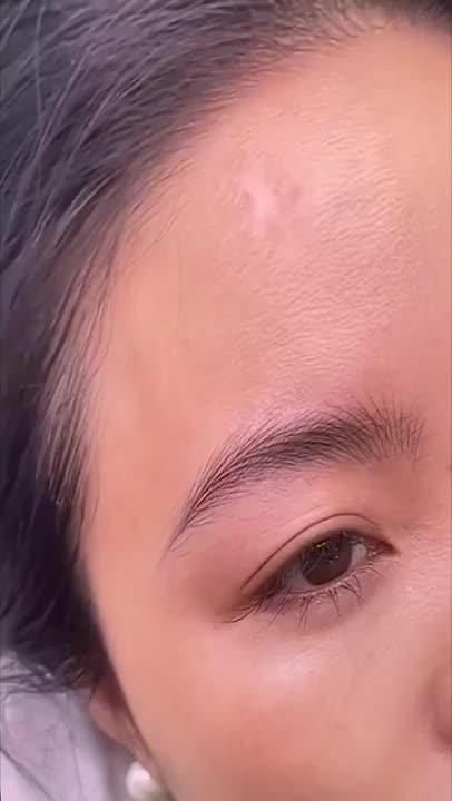 @운정피부관리 서연뷰티
