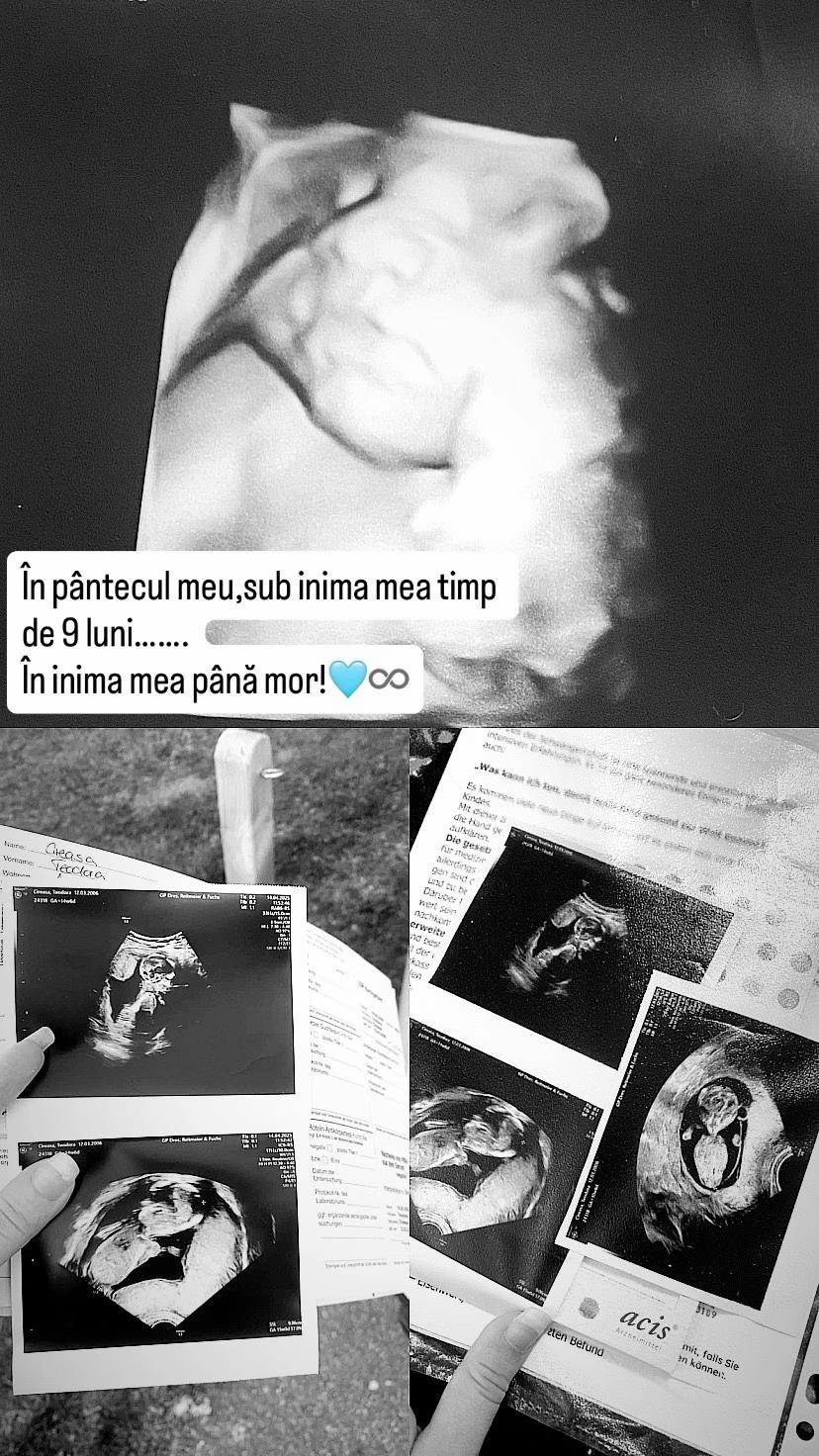 @Teoo💫