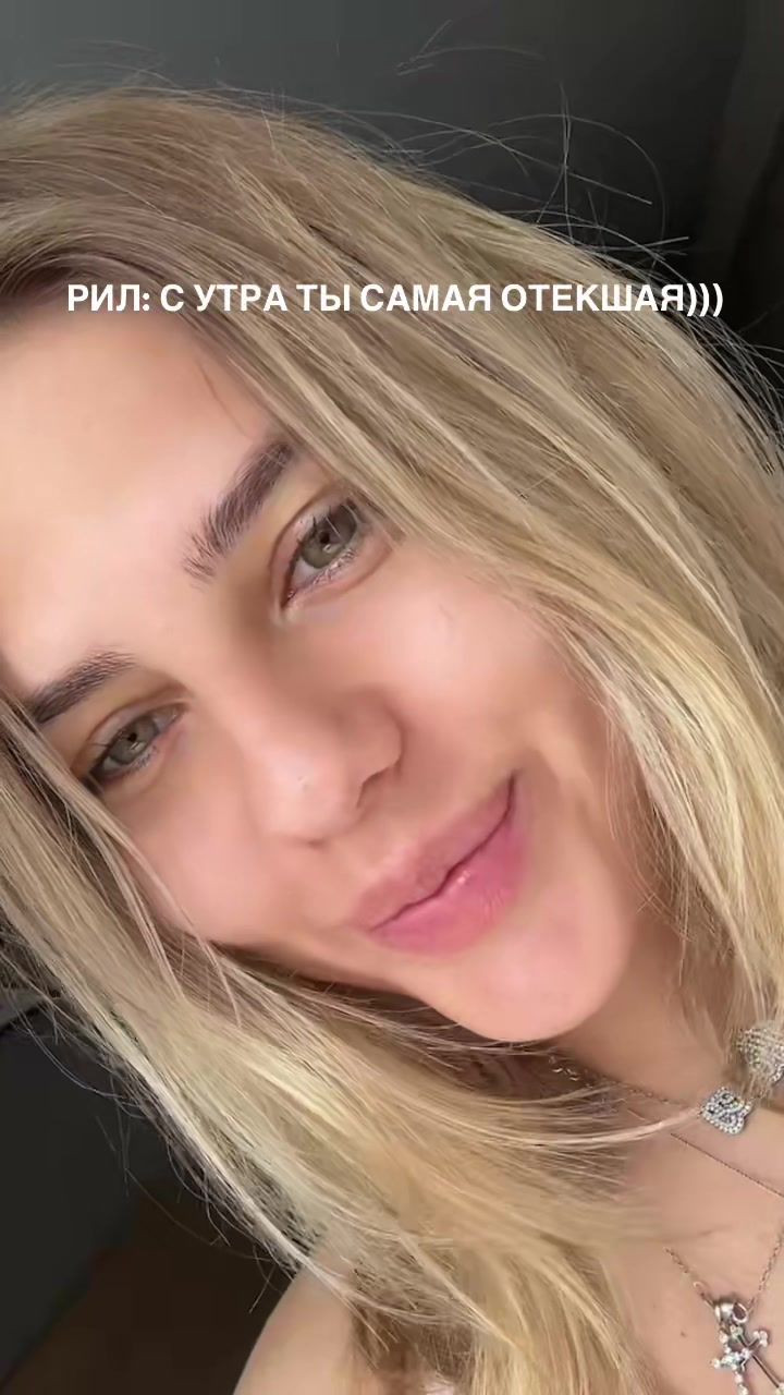 @HONEY