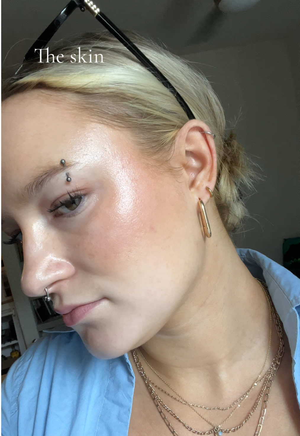 @Bay | Acne Baddie ✨