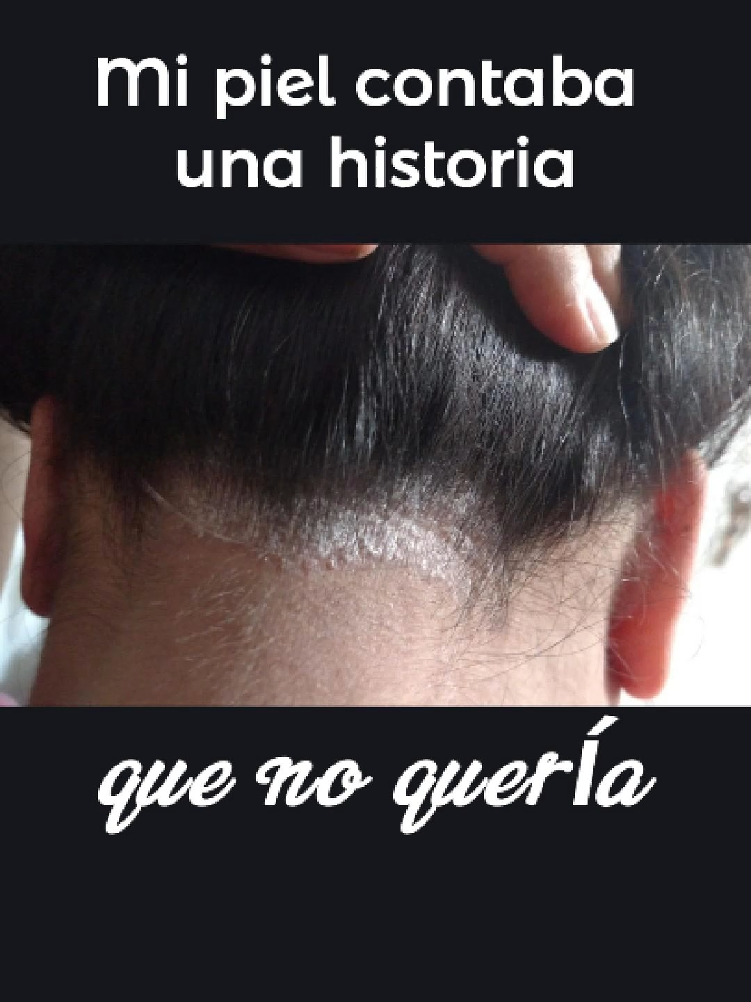 @Salud Transdermica