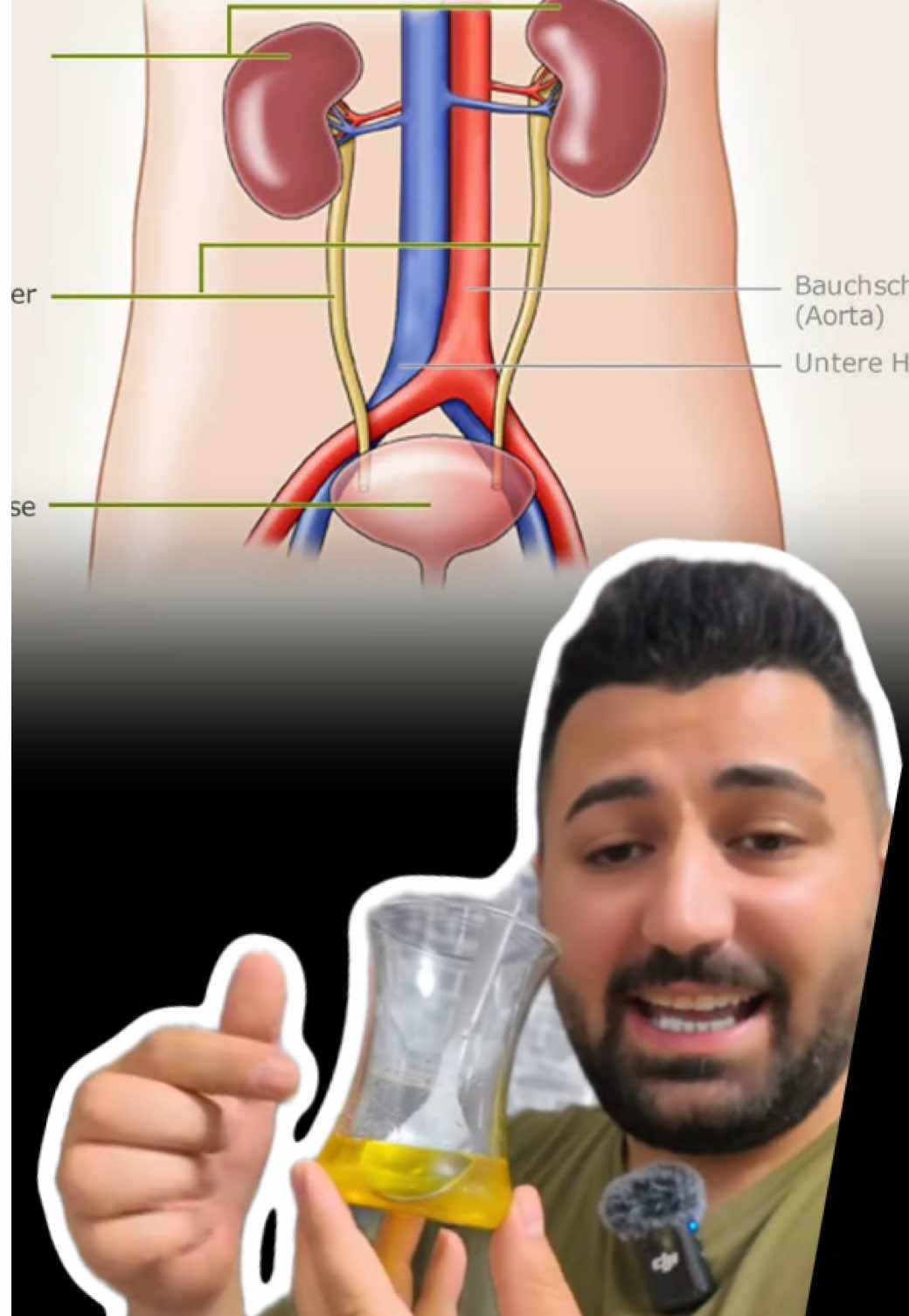 @Devran_official