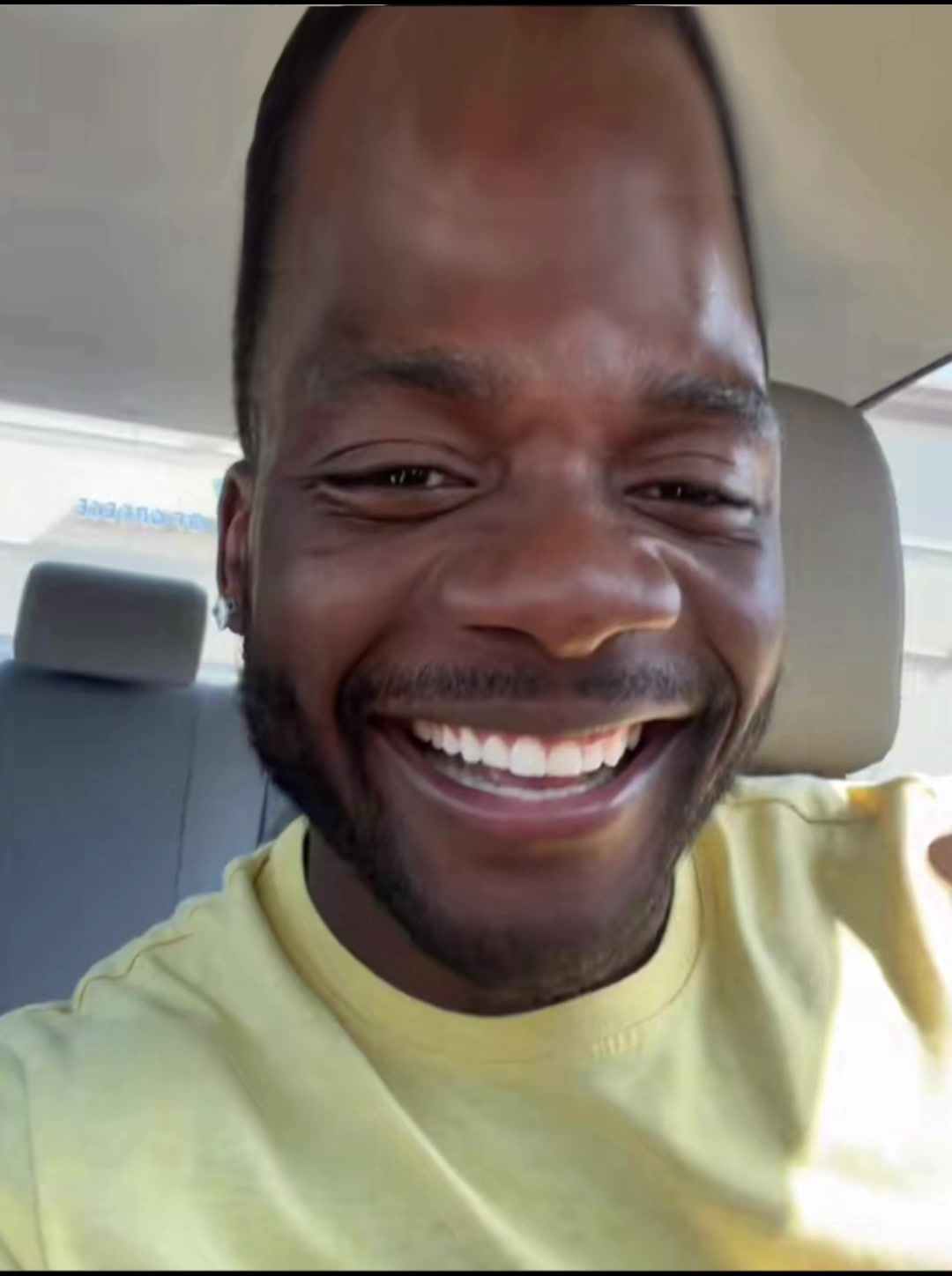 @osasioos.forehead