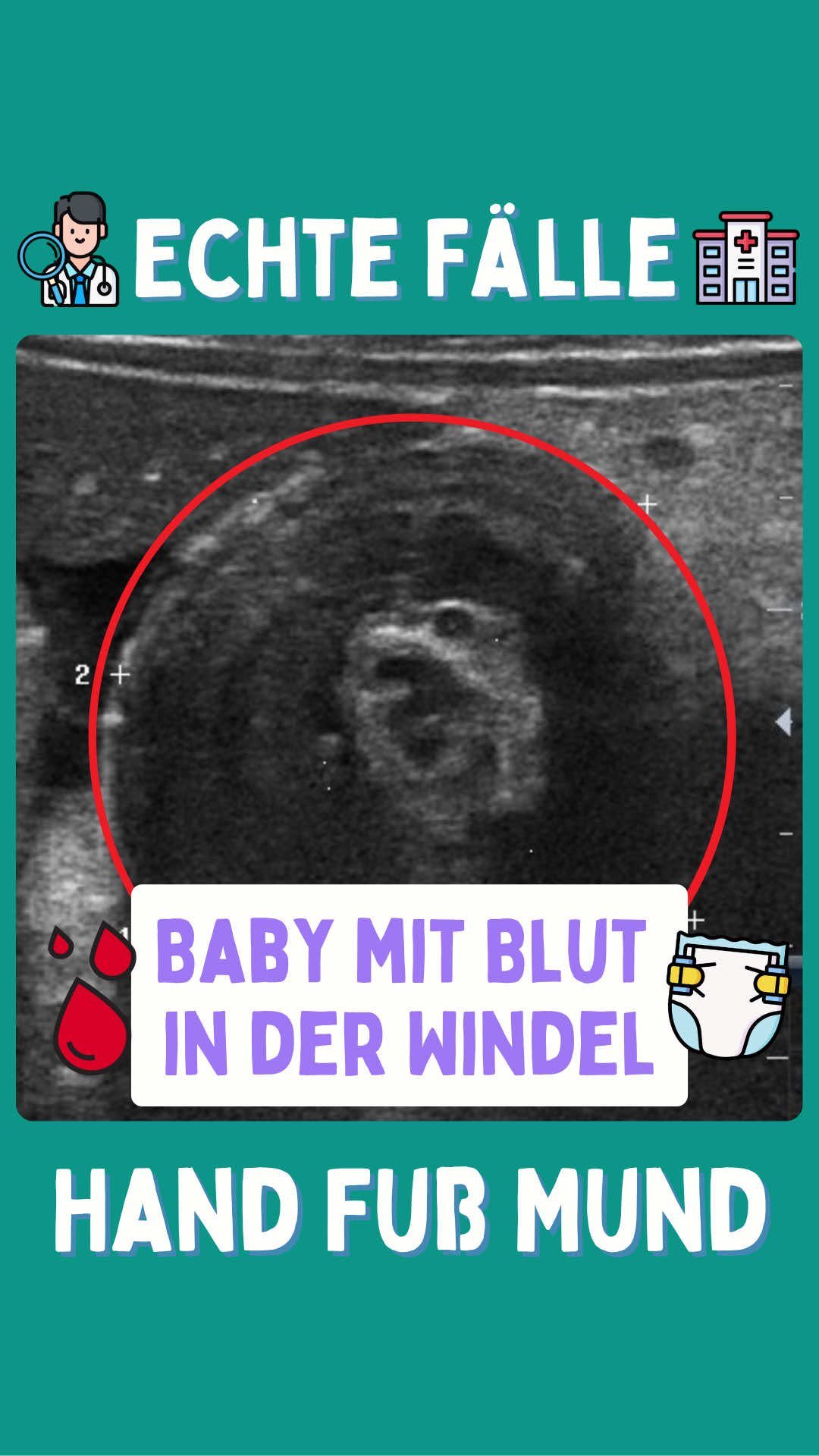 @Hand, Fu&szlig;, Mund