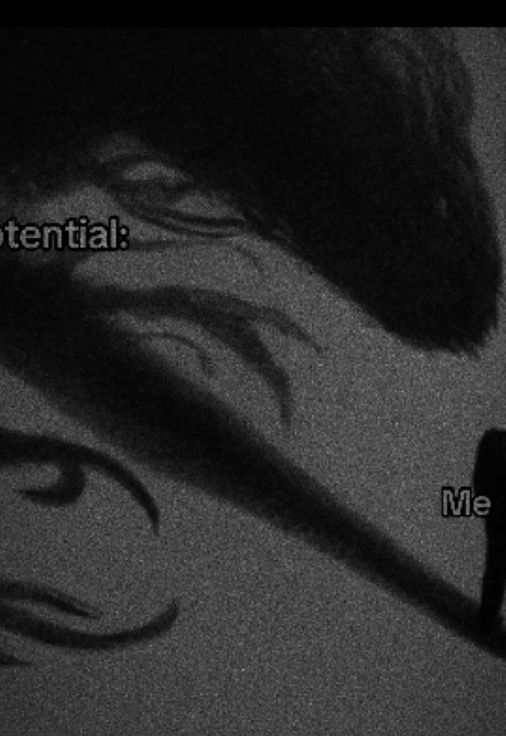 @rebody&trade;