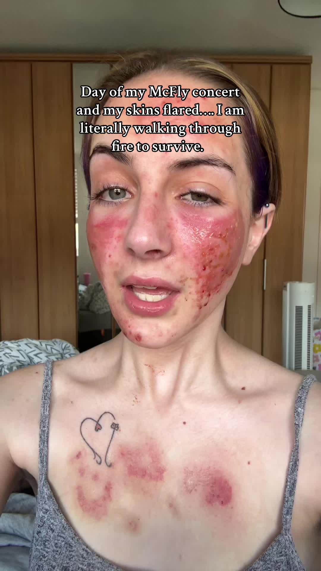 @Bethschronicdiaries 🦋❤️&zwj;🔥♿️