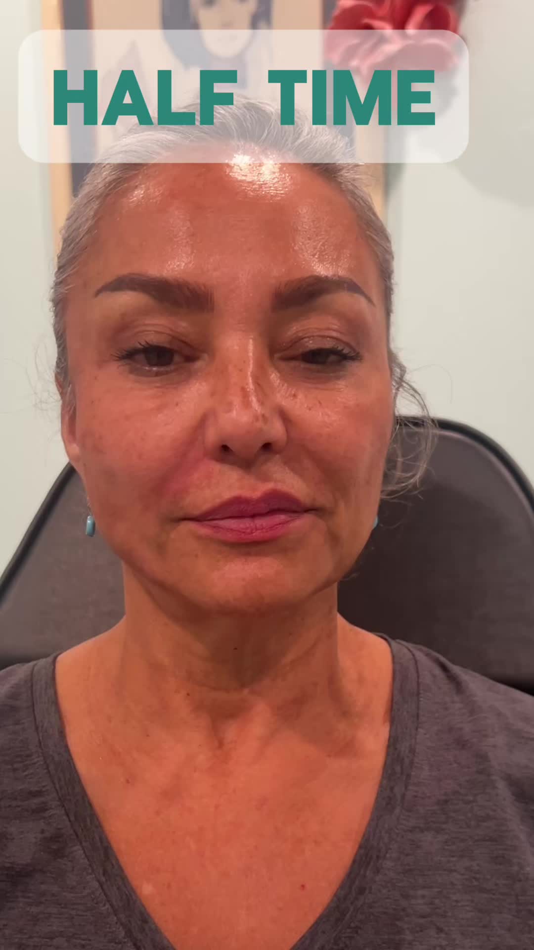 @lumaviemedspa