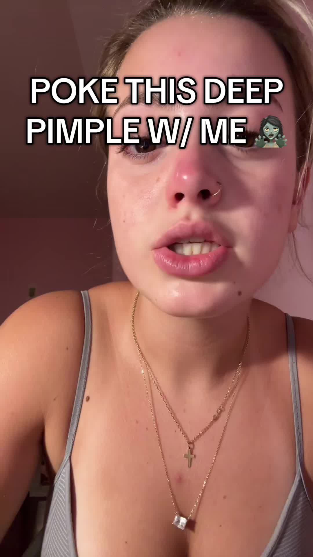@cheeto🙈