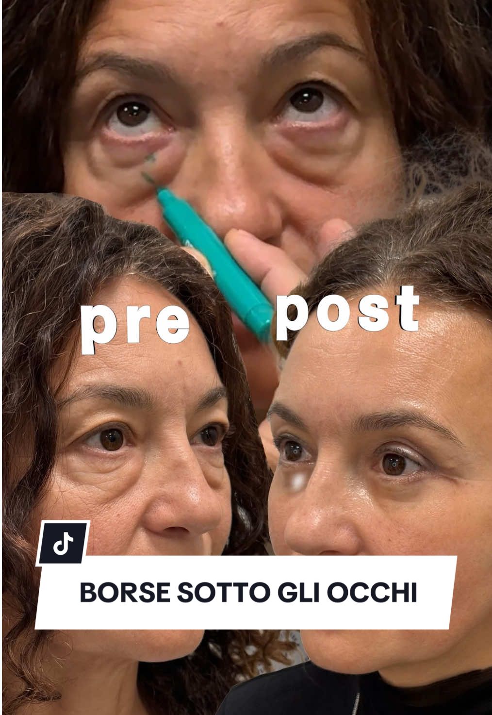 @CHIRURGO DELLO SGUARDO