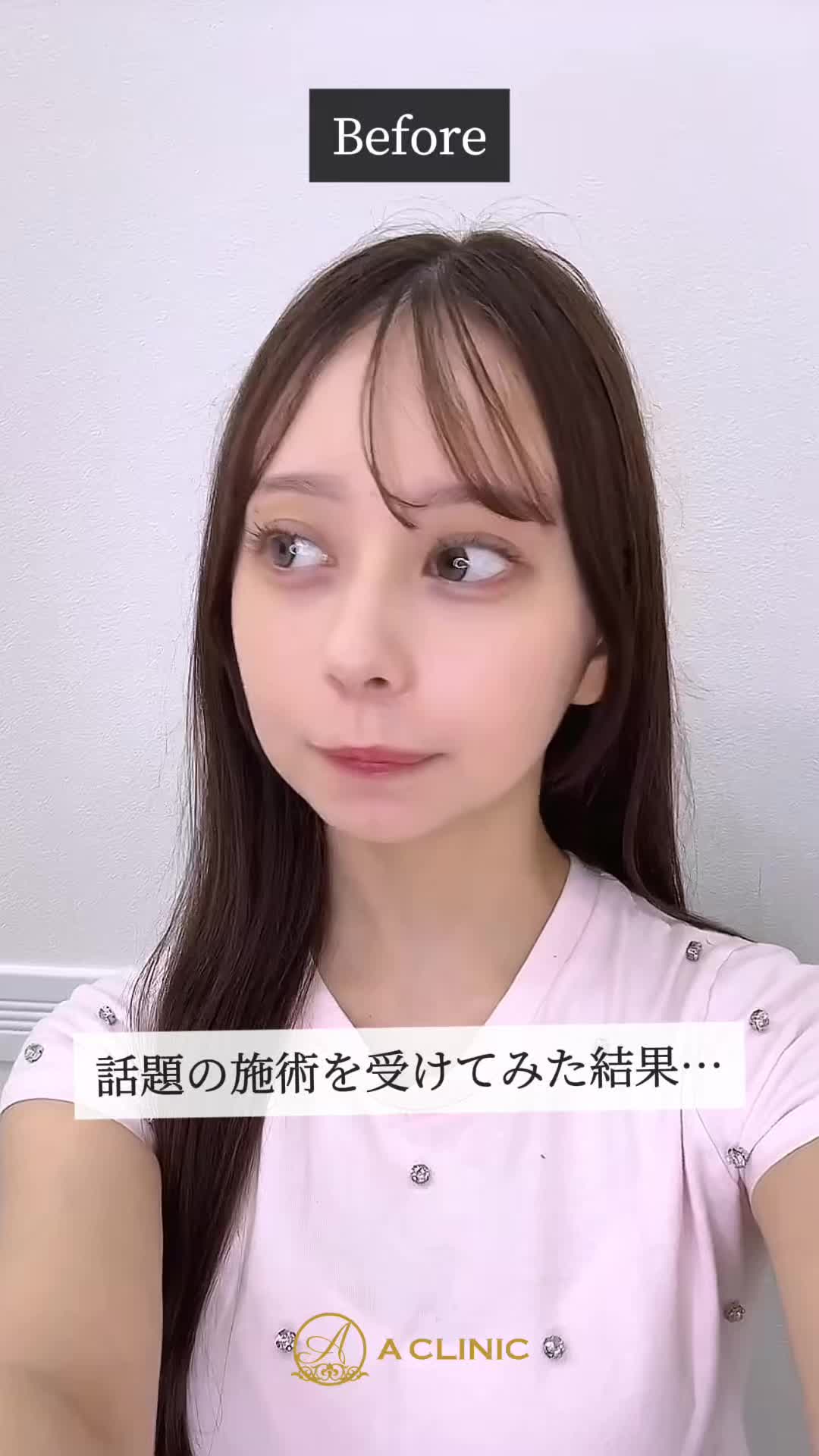 @ACLINIC池袋院【小顔/中顔面短縮】