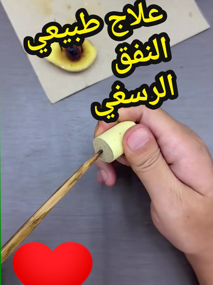 @مركز الأصيل للعناية الجسدية 2