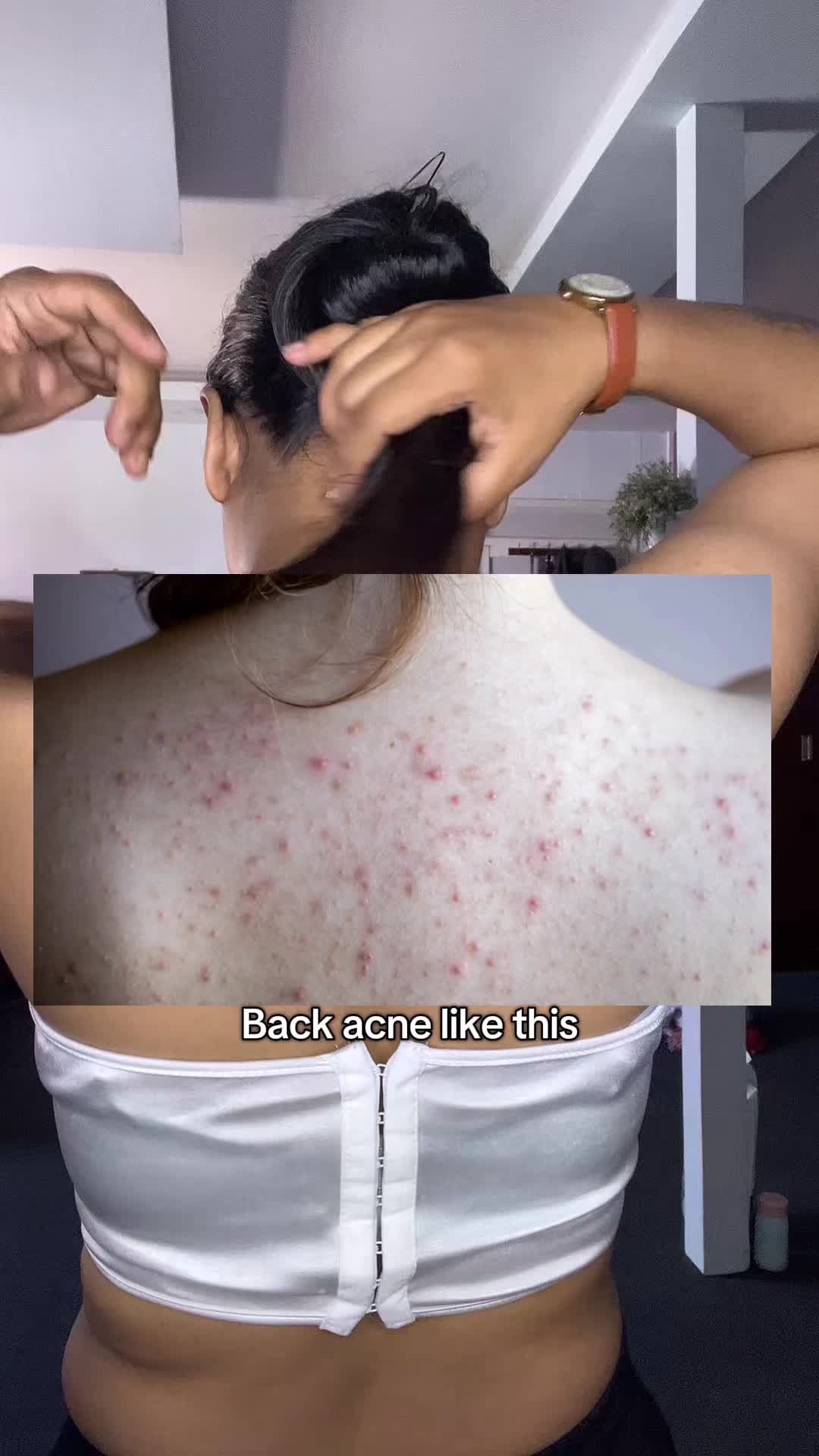 @Anuradha