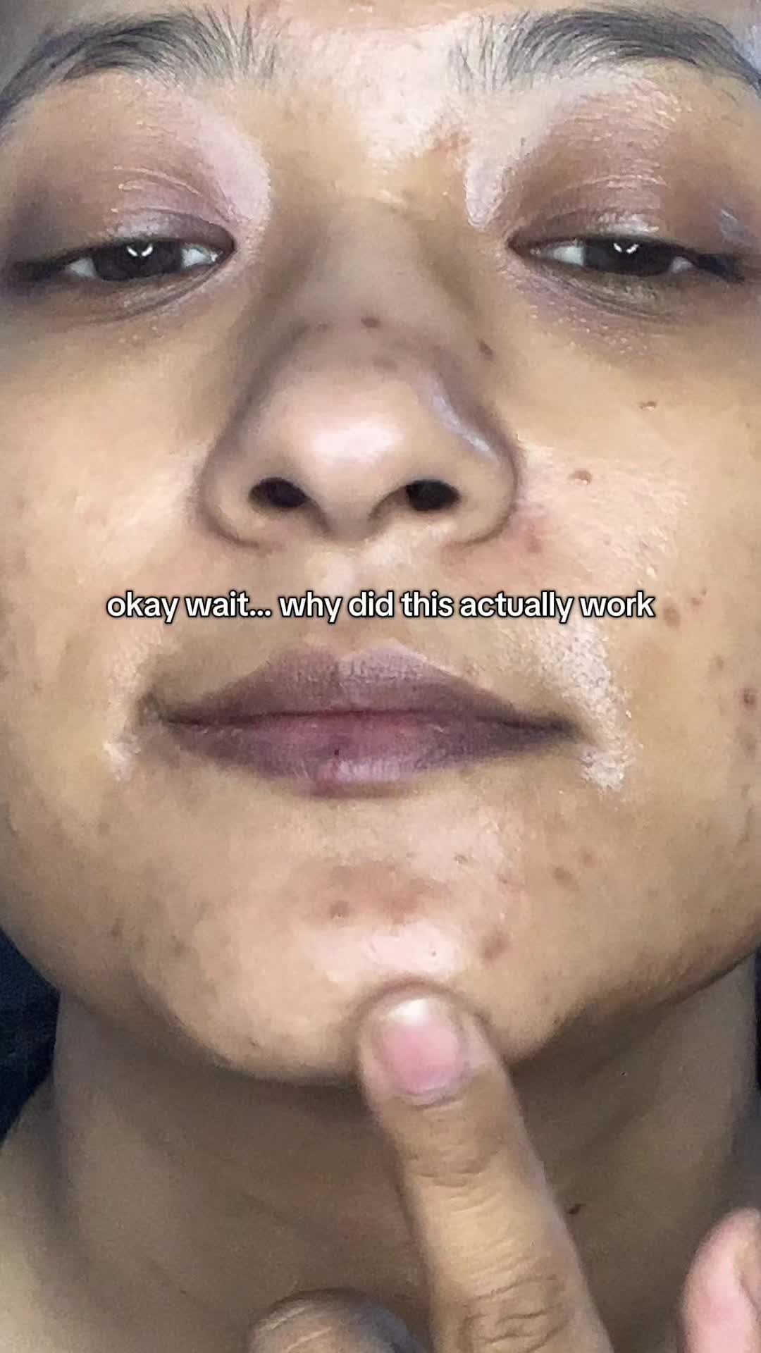 @Anuradha