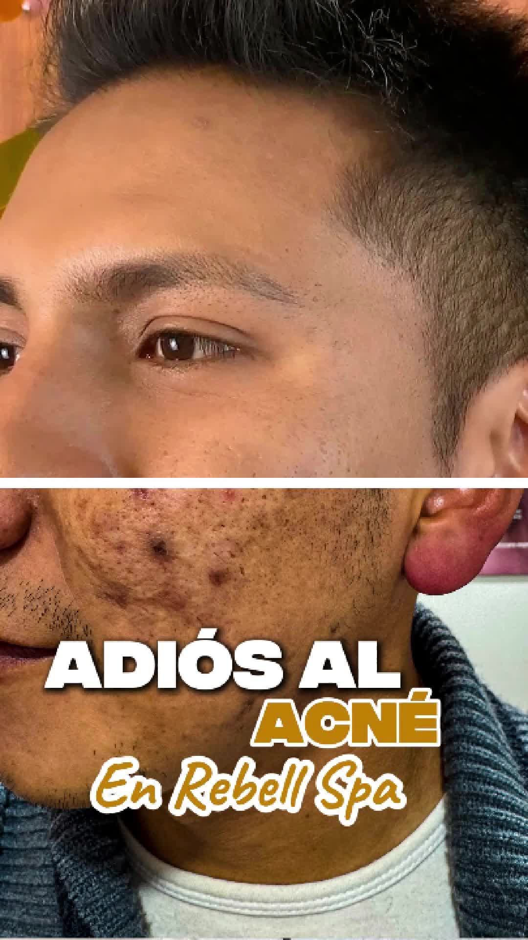 @RebellSpa