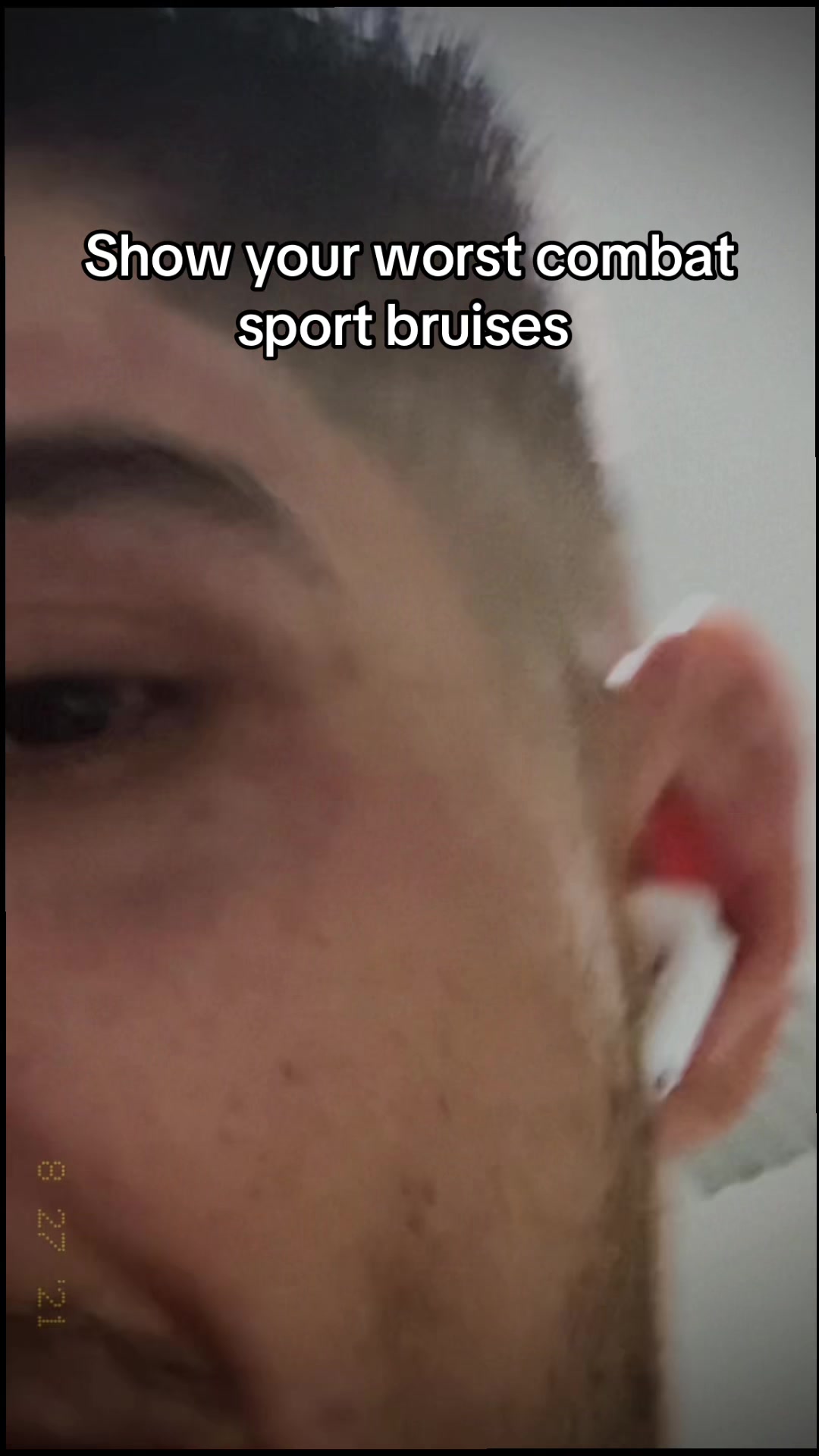 @Tony